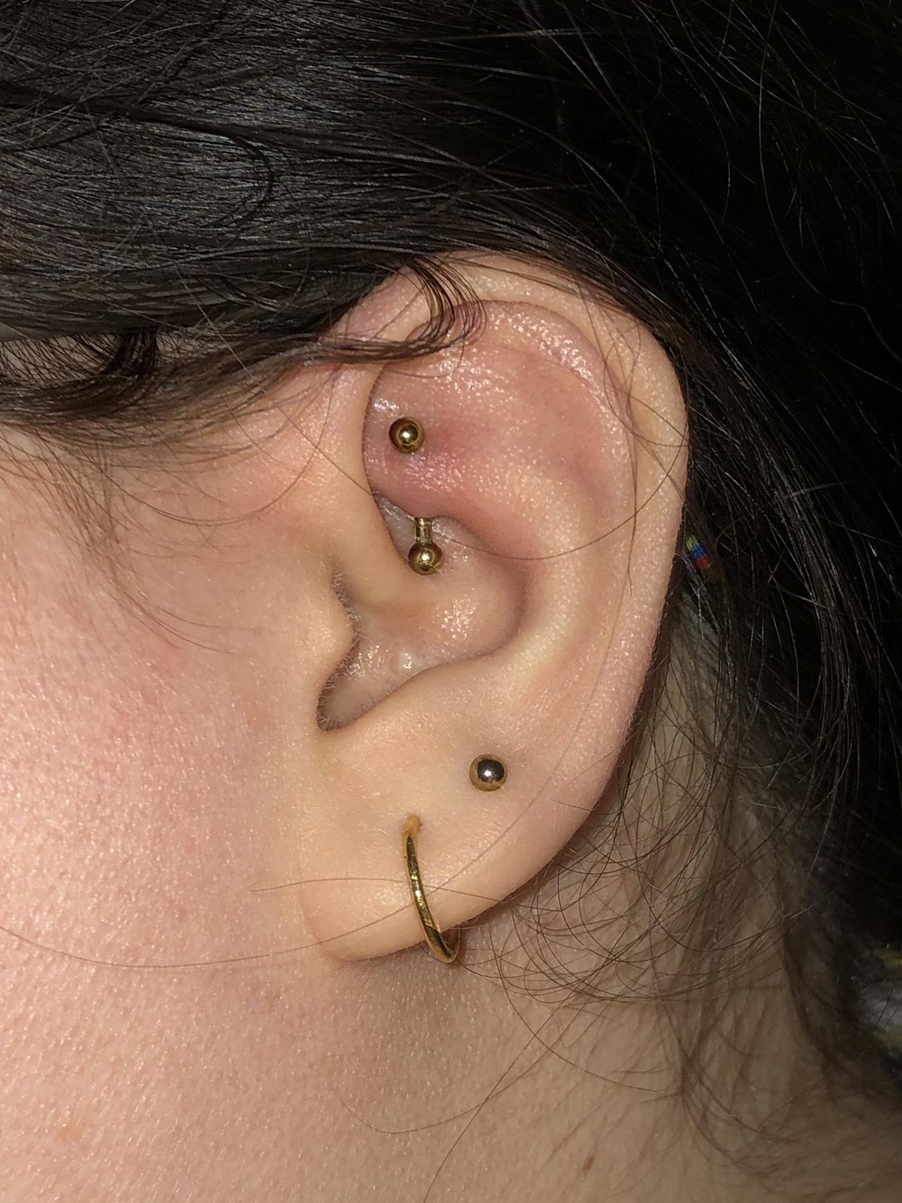 How long was your rook swollen? This is after about 3 and a half weeks