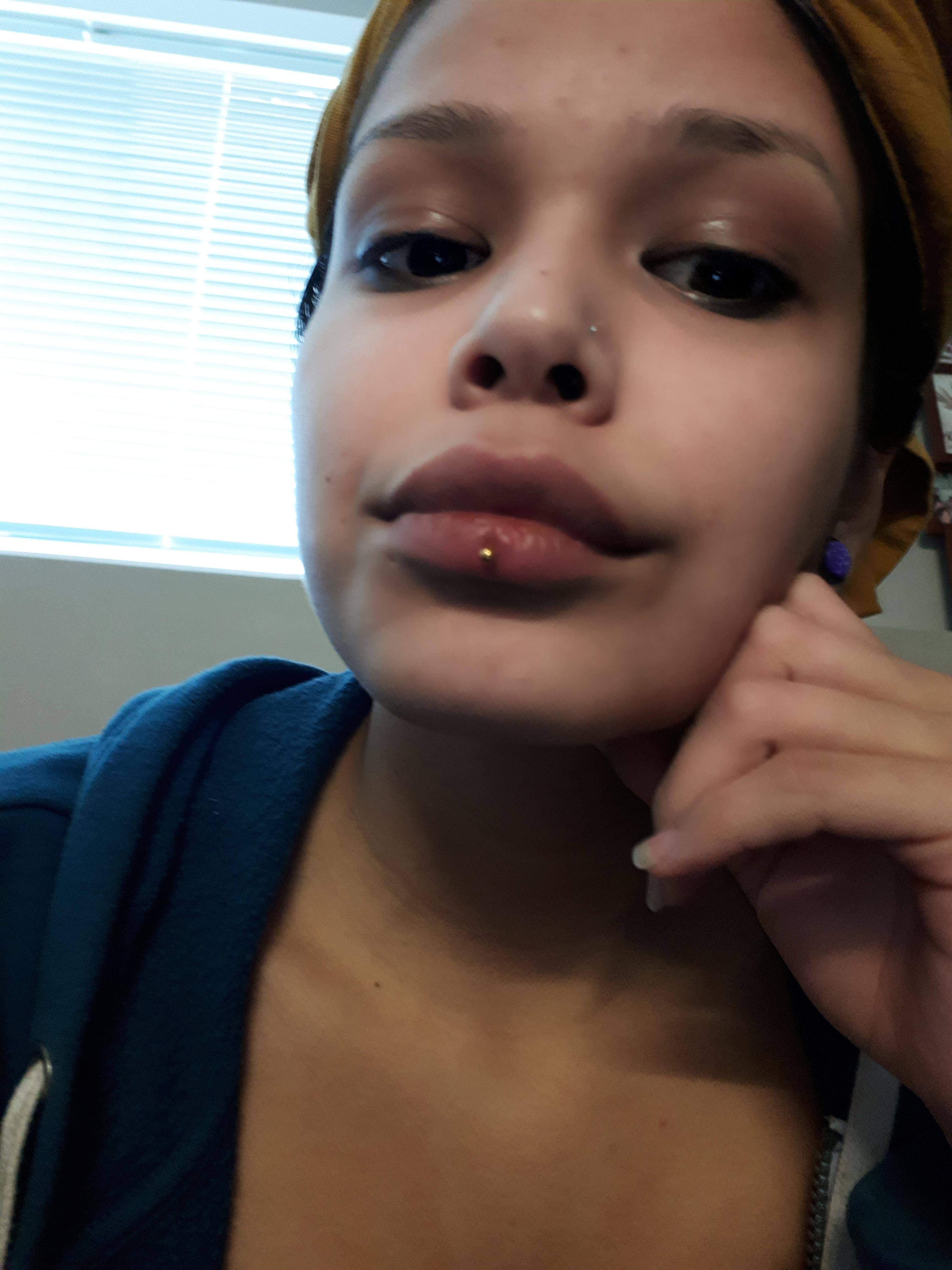 Got an Ashley in the winter and now my lips are chapped! What can I use