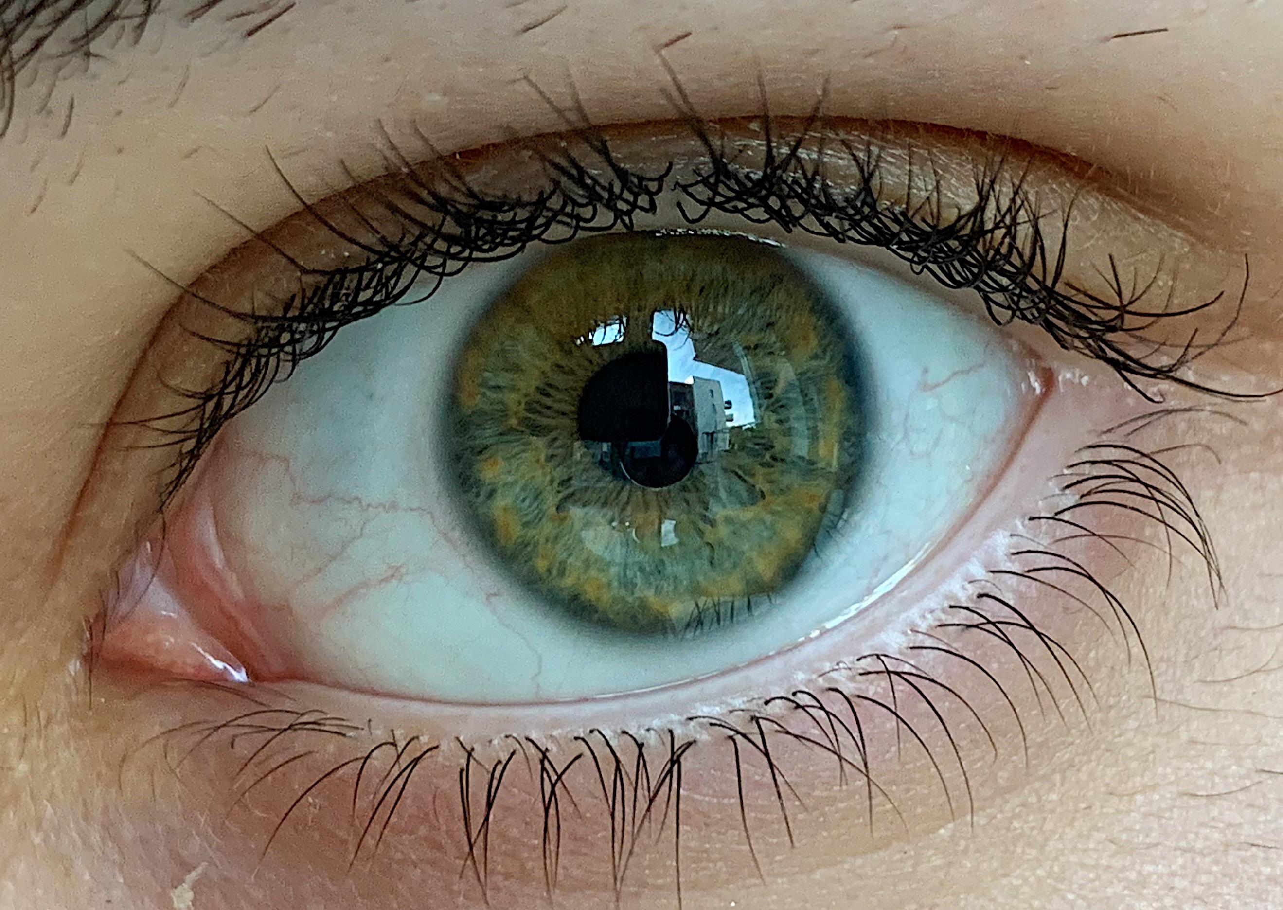 My eye seems to have 3 different colors, blue on the left, green on the