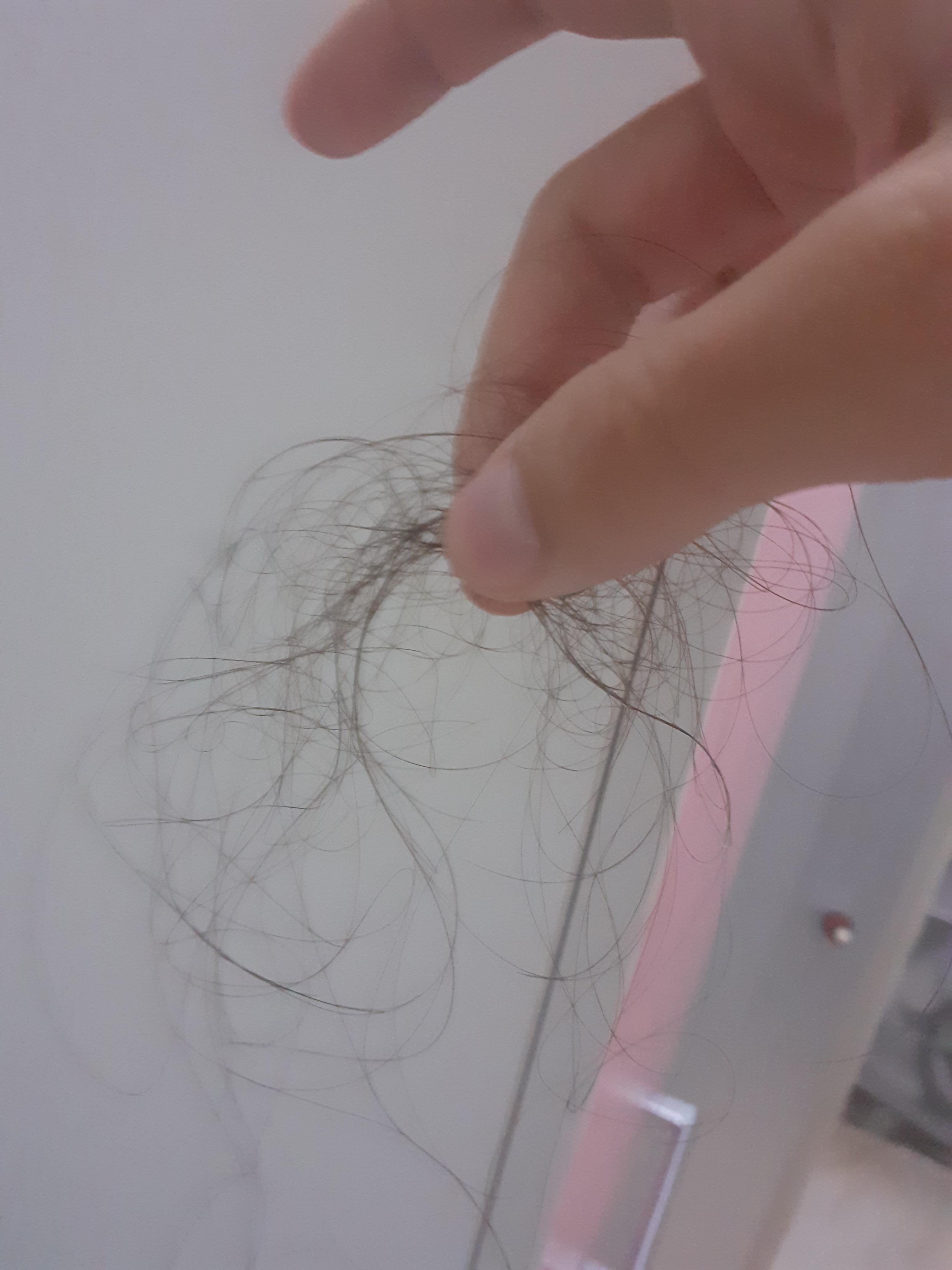 Is losing this much hair everytime i comb normal? I comb my hair every
