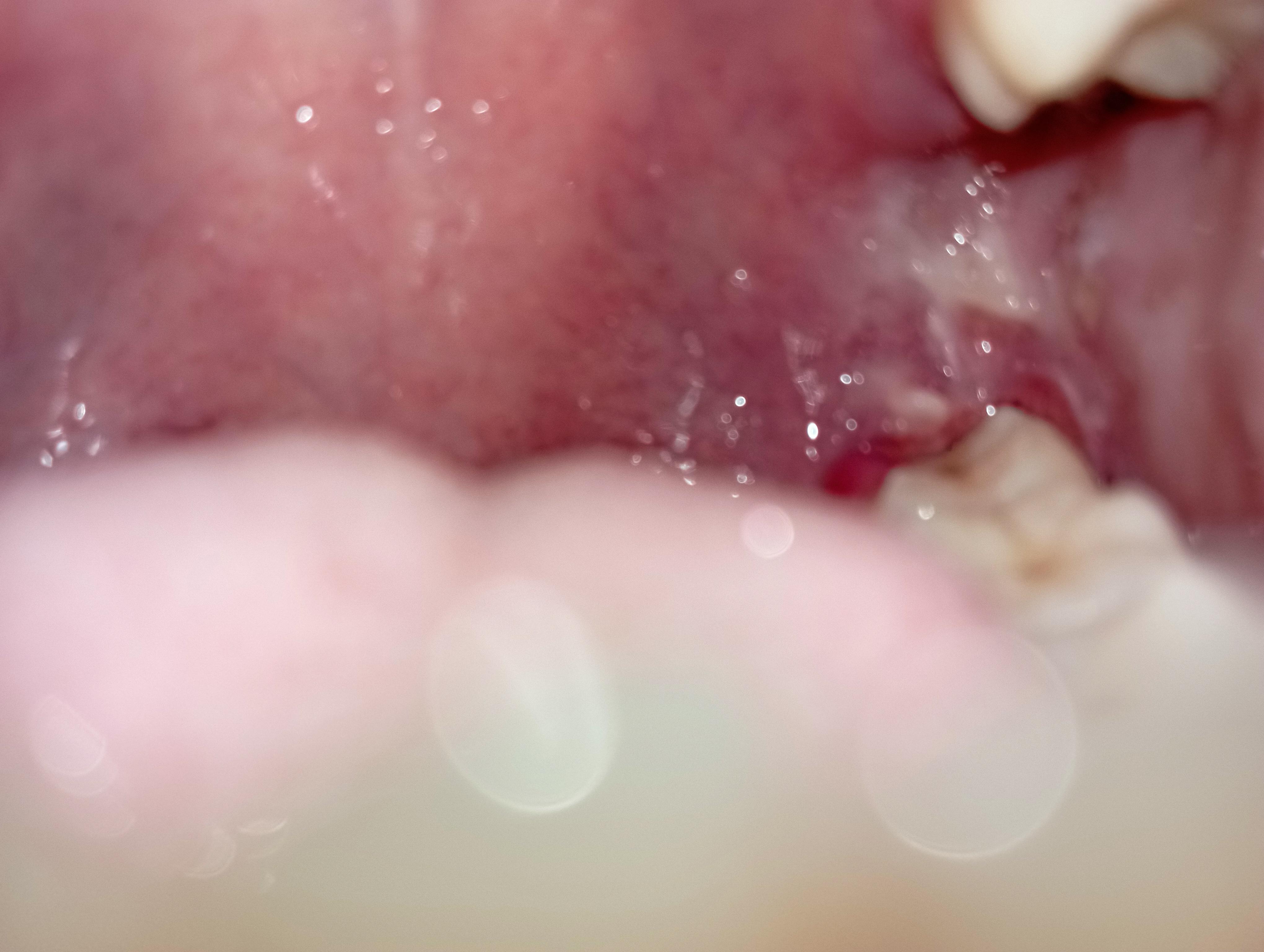 Can anyone please tell me what is this? I think this is major canker