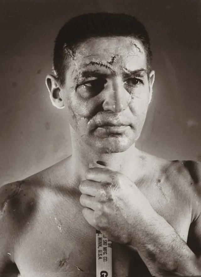 The face of a hockey goalie (Terry Sawchuk) before masks became