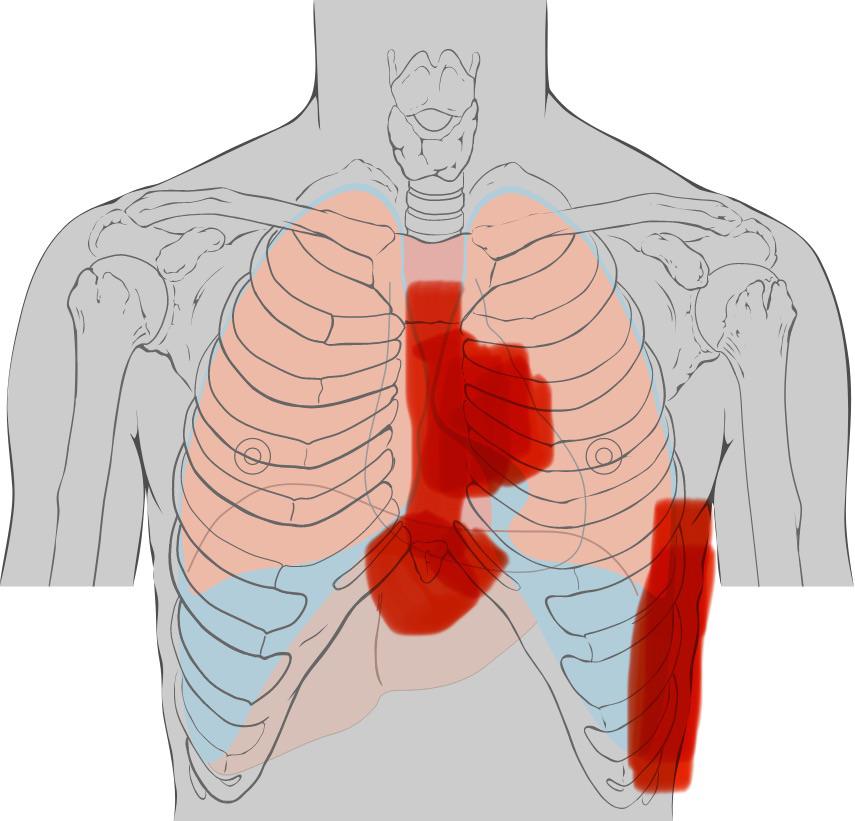 Anyone feel pain below the ribcage? r/costochondritis