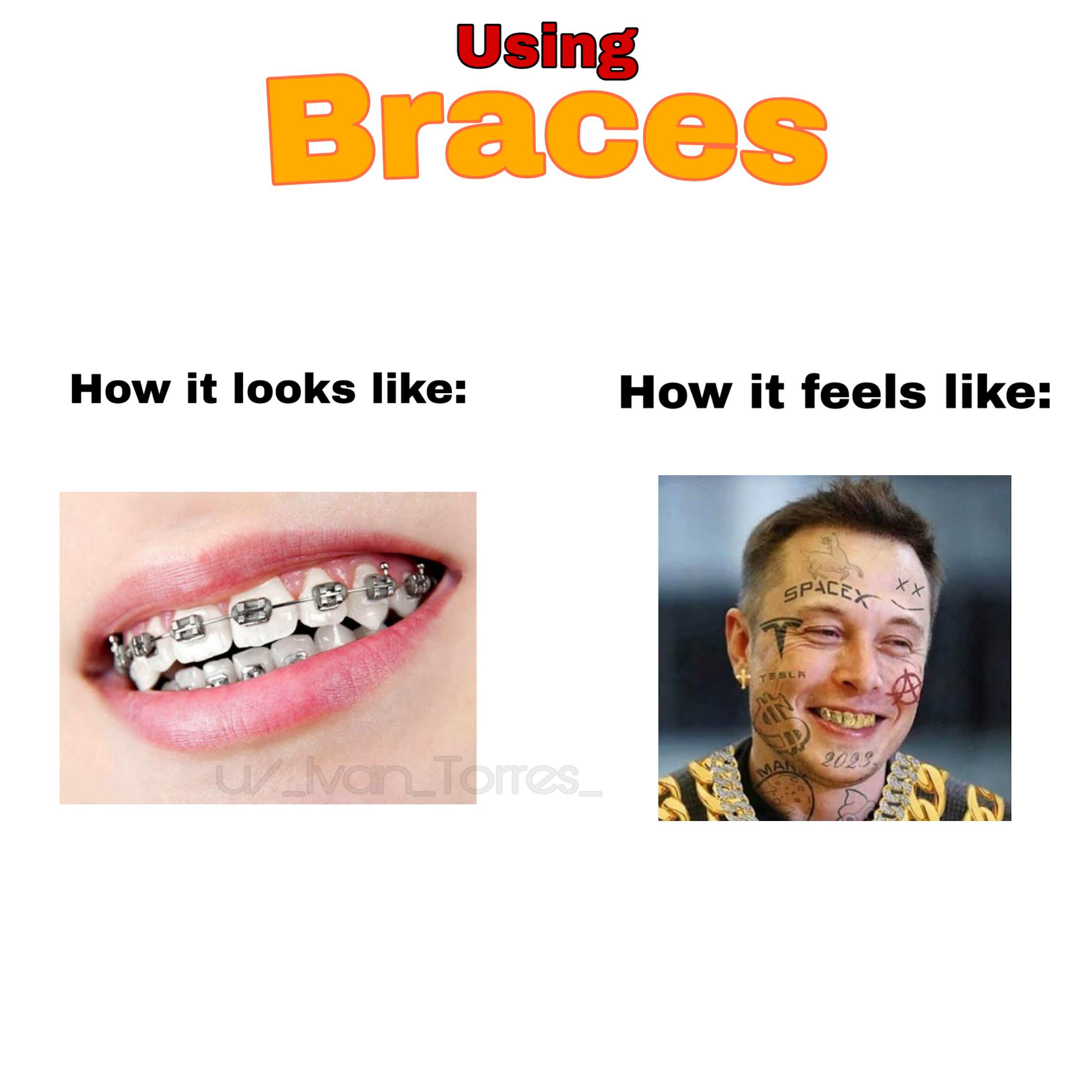 I just got my braces three days ago! (Yes, i know that braces hurt