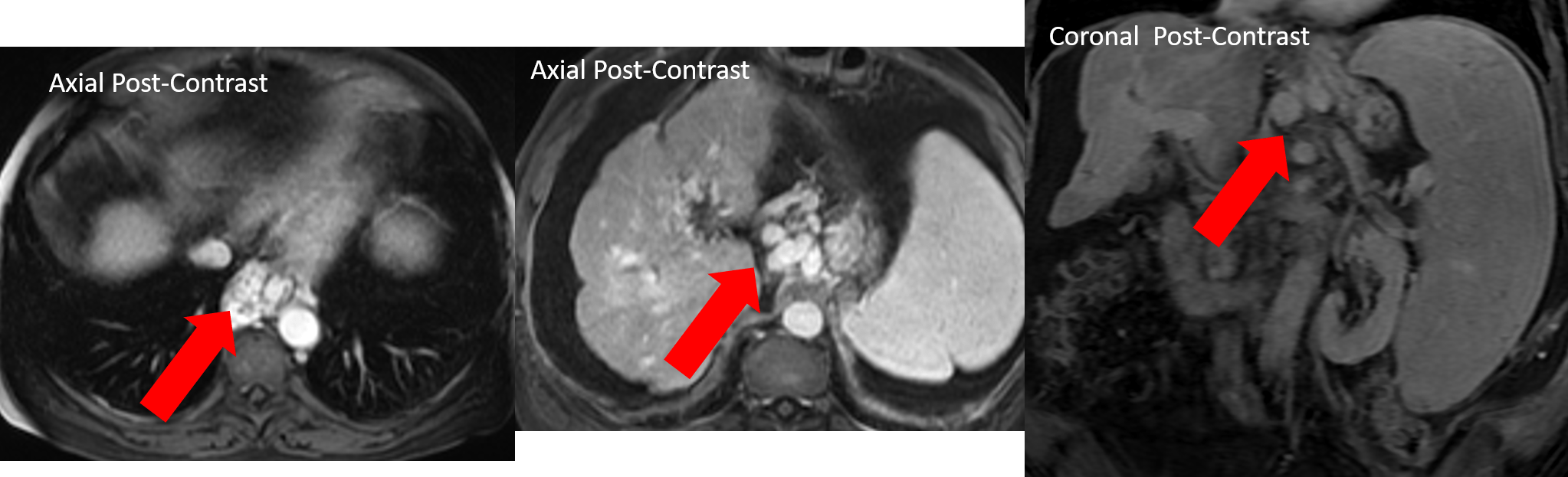 Radiology Case [clinical] r/medicalschool