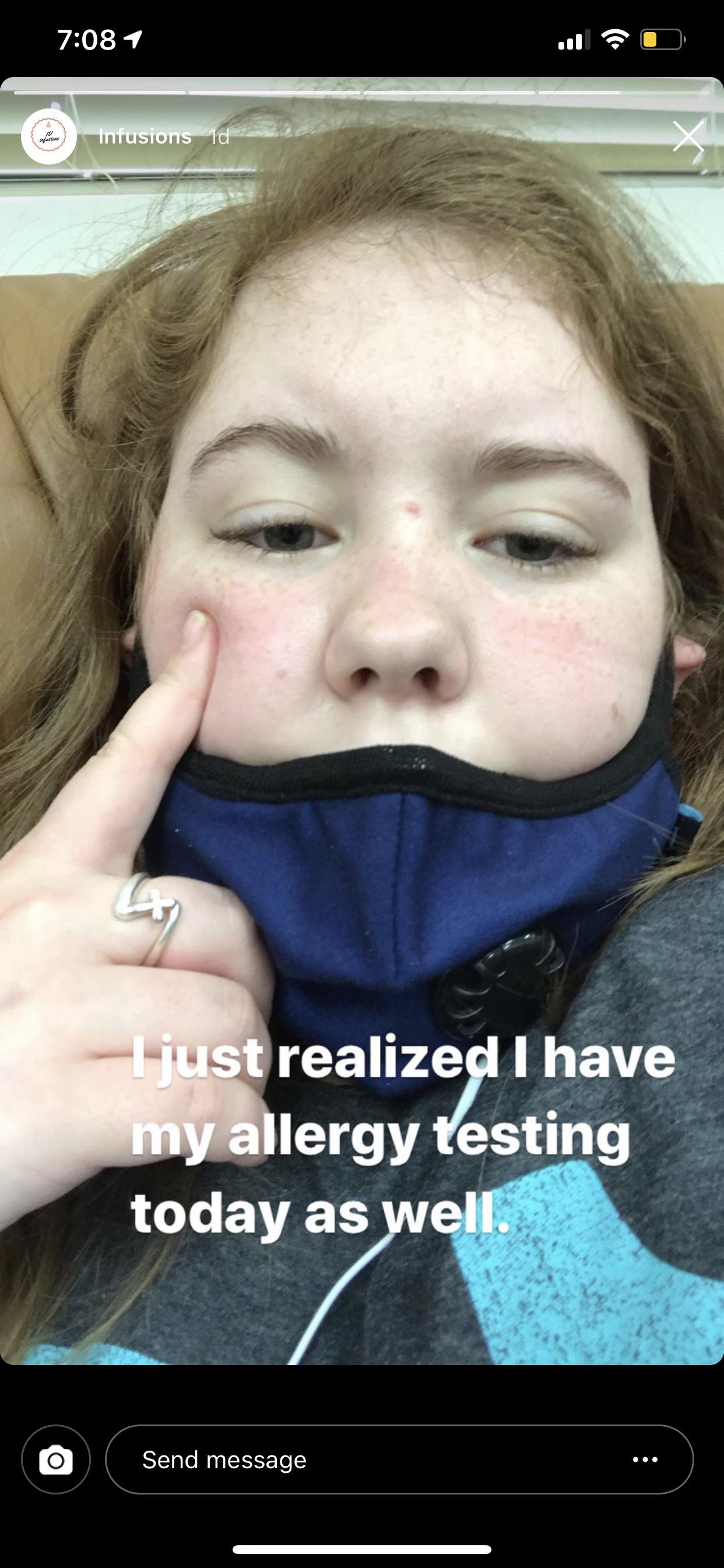 Allergies so bad that the mask doesn’t need to be worn correctly/over