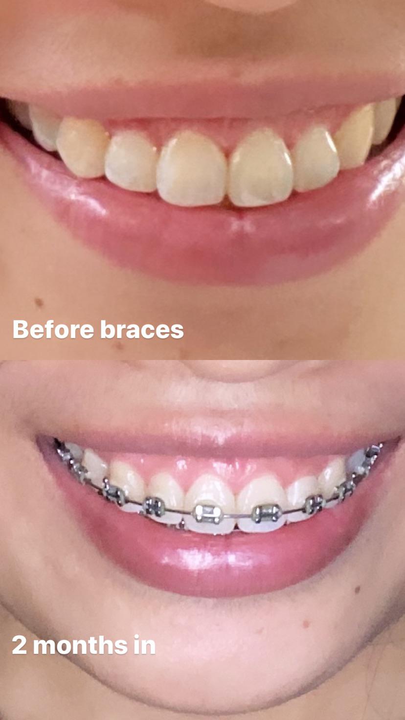 Not really an obvious progression but I want to post it anyway. I have