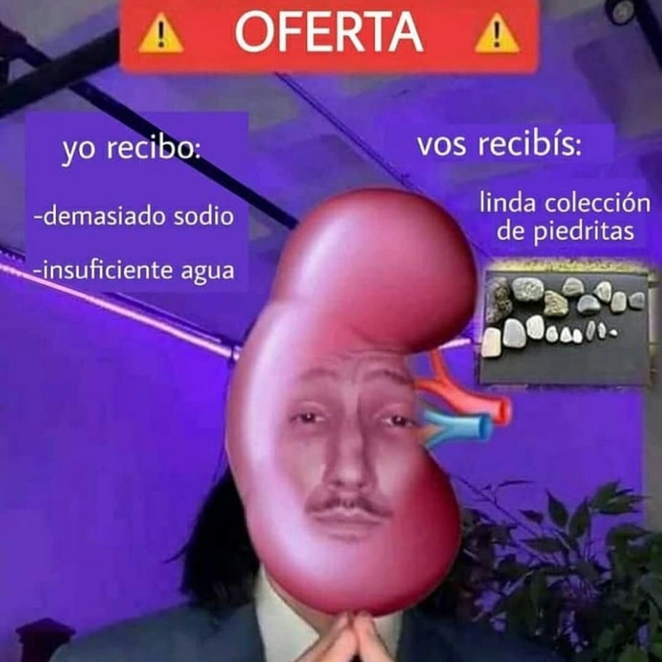 Me pasa siempre r/MAAU