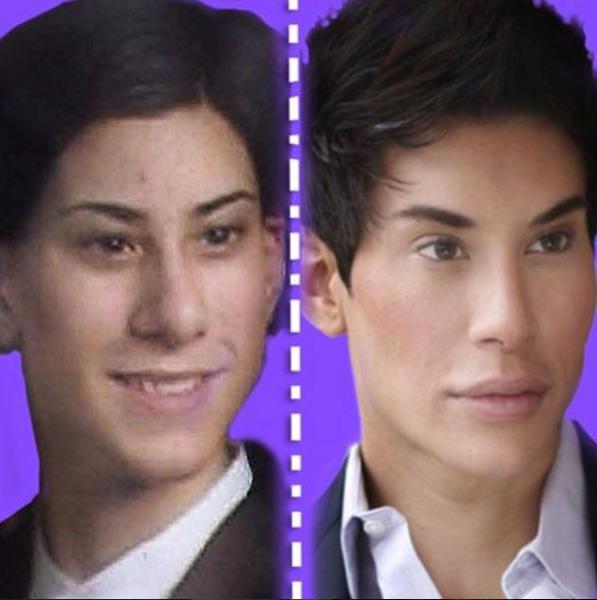 Plastic surgery made him look too fake and plastic, says he’s aiming to