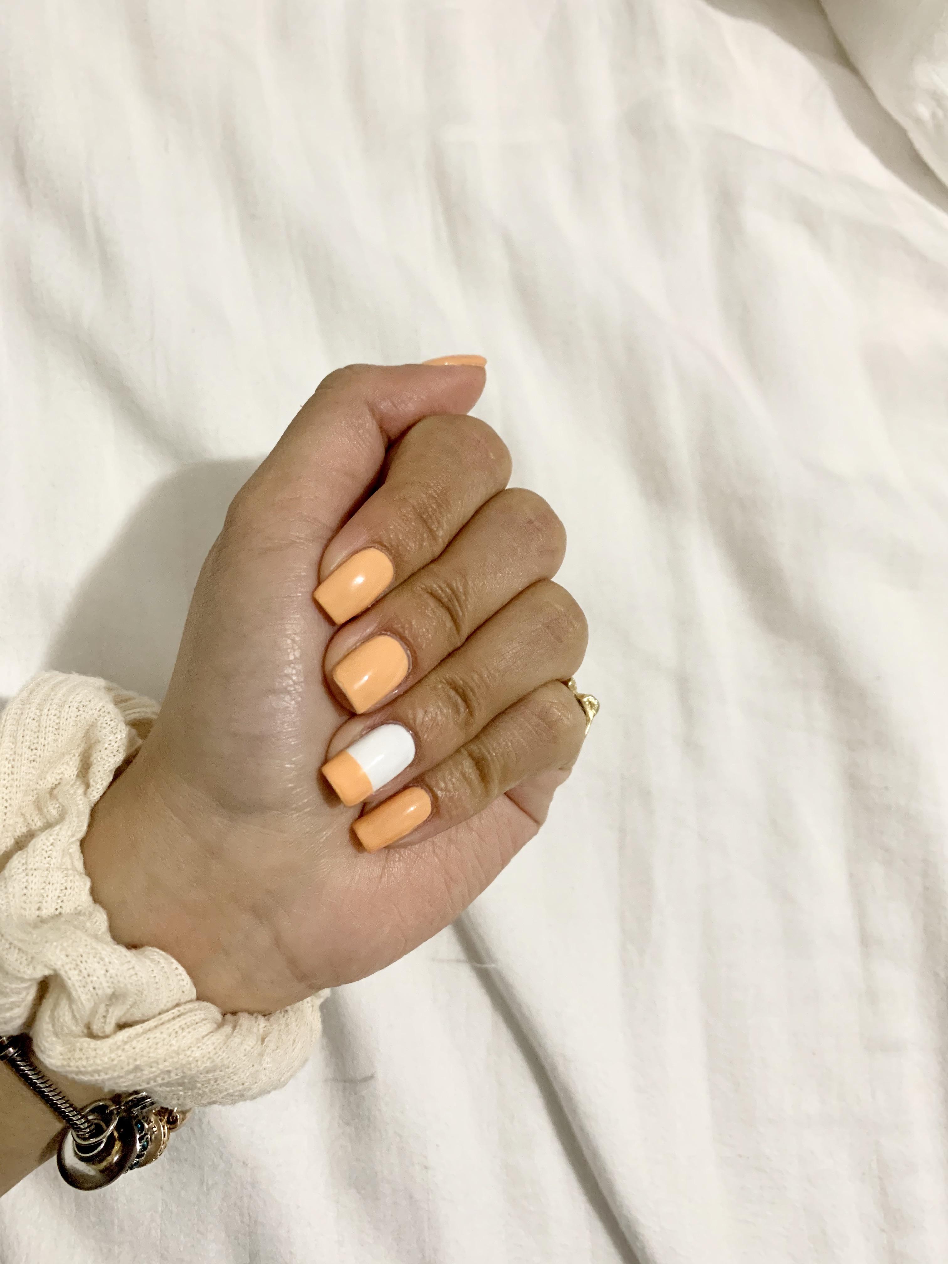 Details 127+ broken nail first aid best ceg.edu.vn