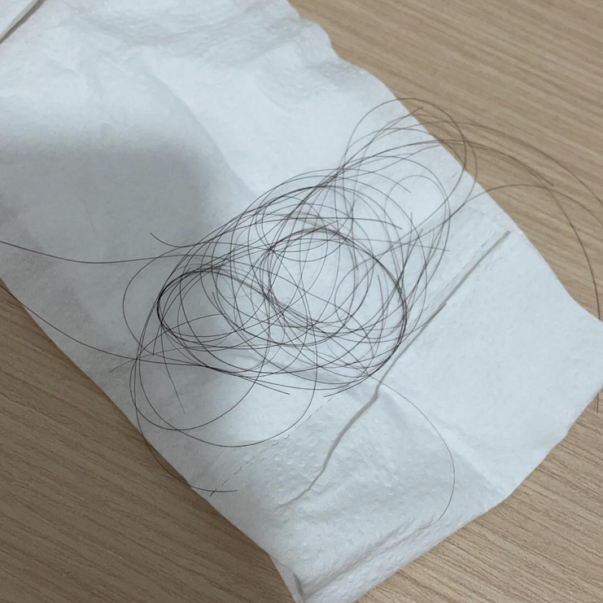 how many hair shedding is normal. I wash hair everyday. Shower 20