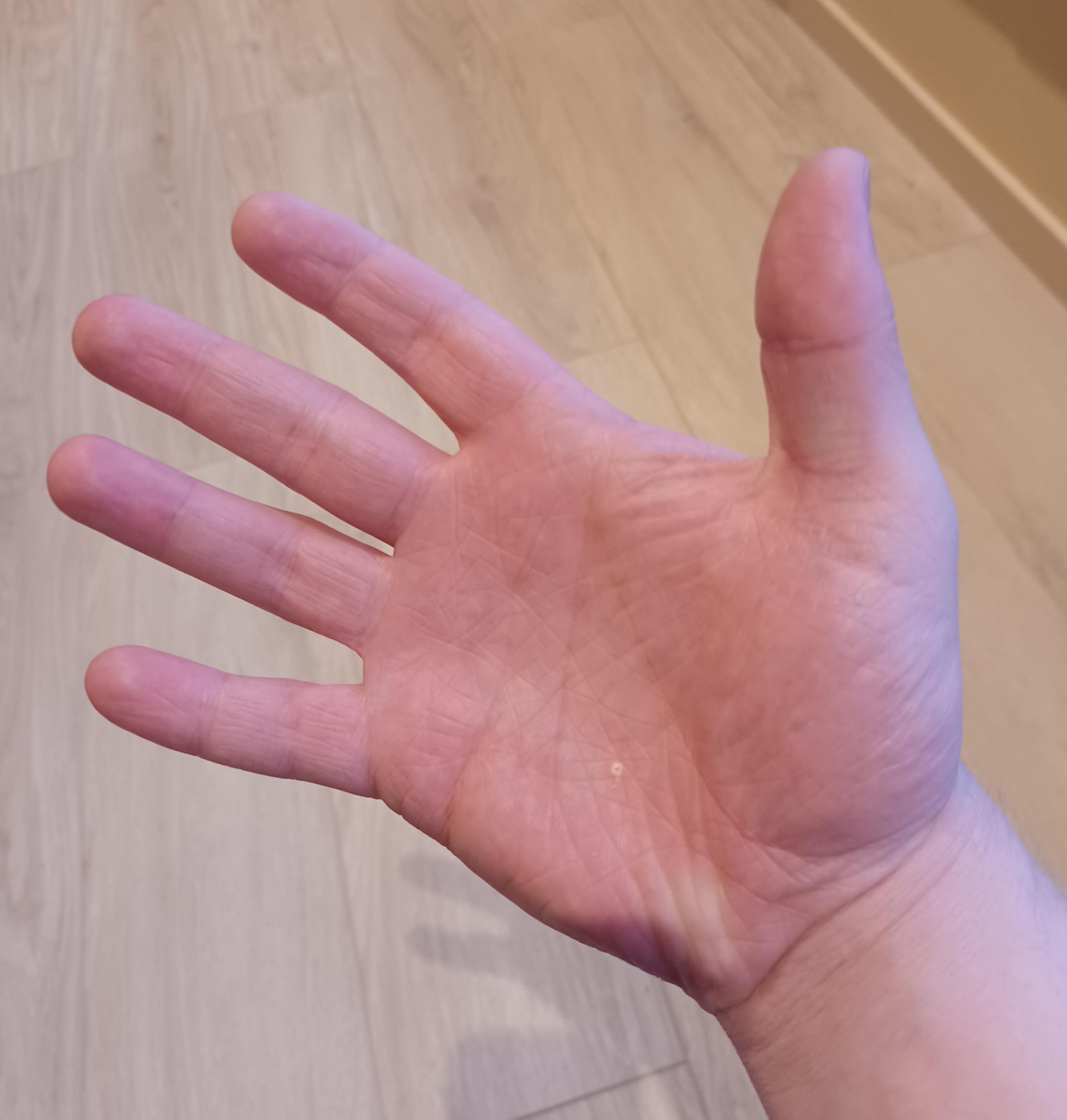 I'm missing 0 fingers on my left hand r/notinteresting