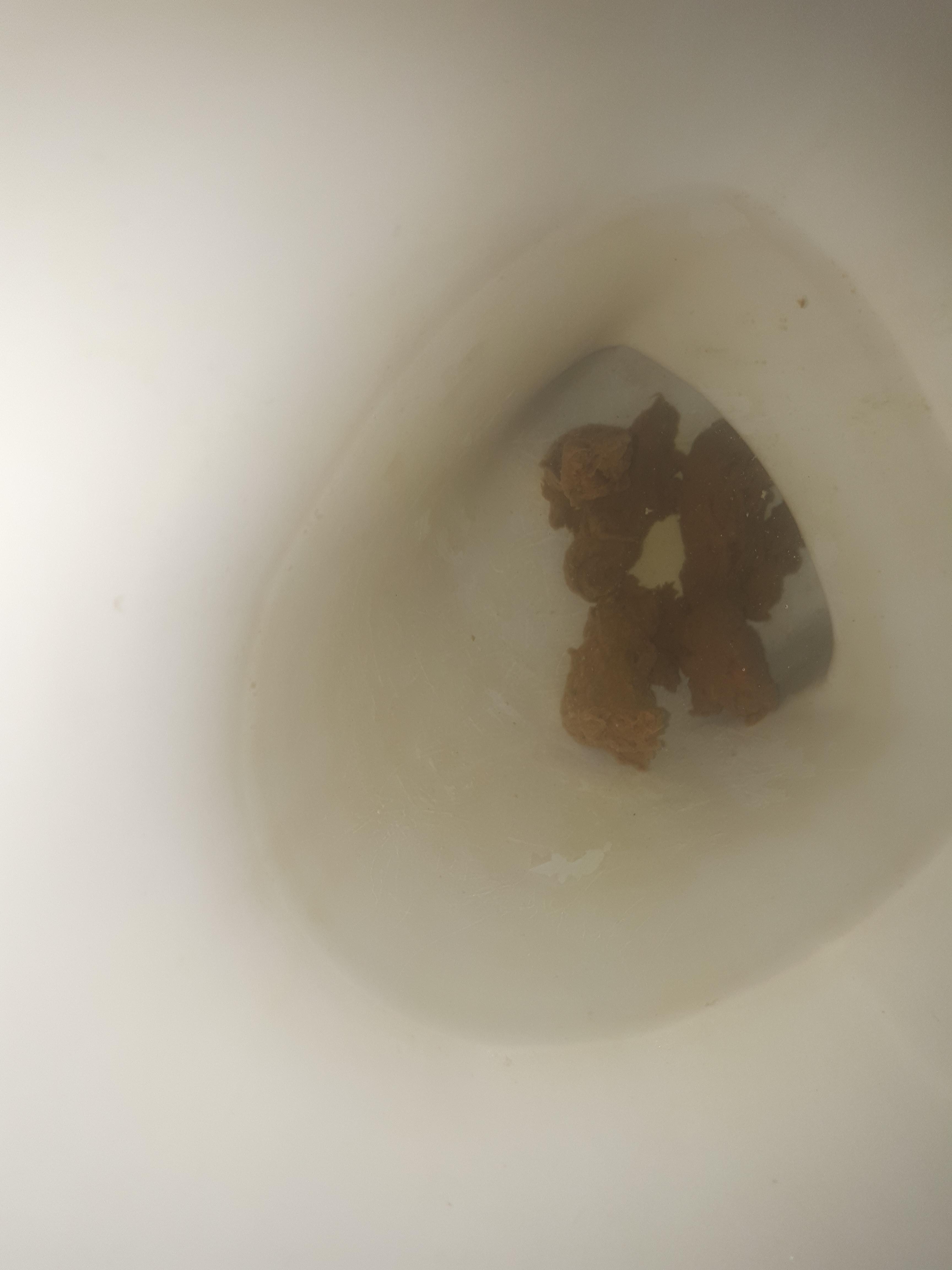 Why my poop is like this? r/poop