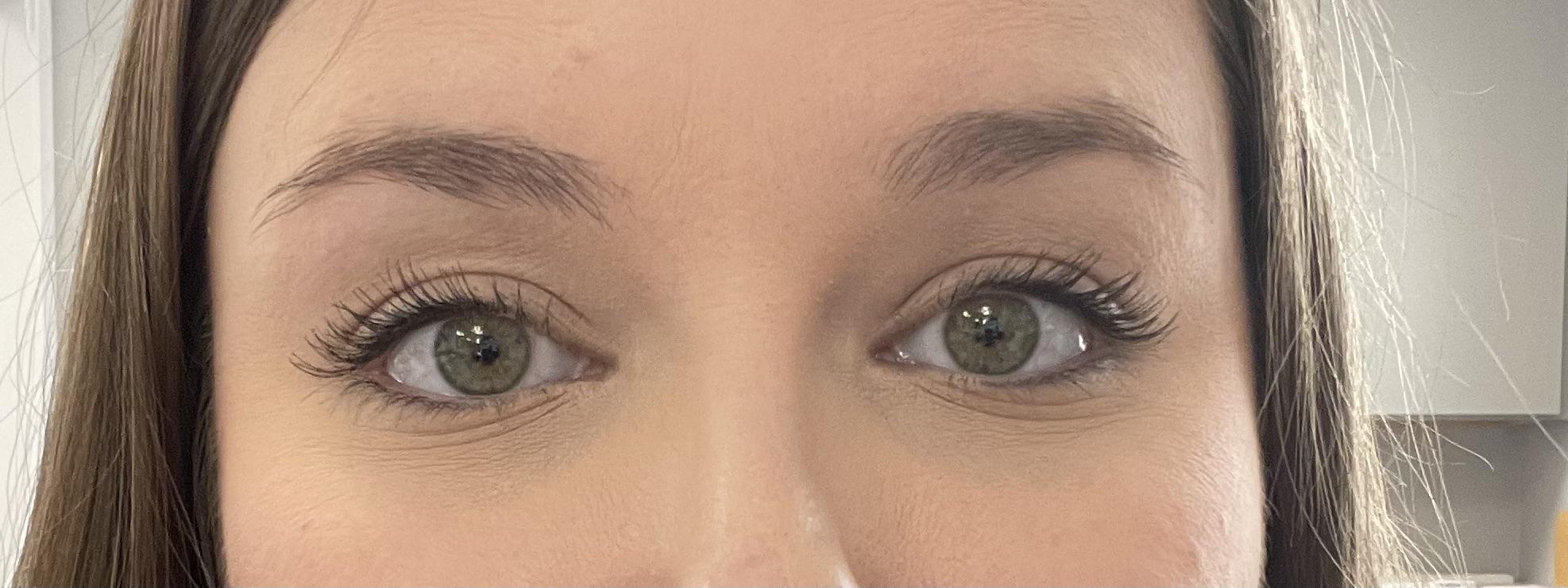 How do I prevent these fine lines under my eyes? I use liquid