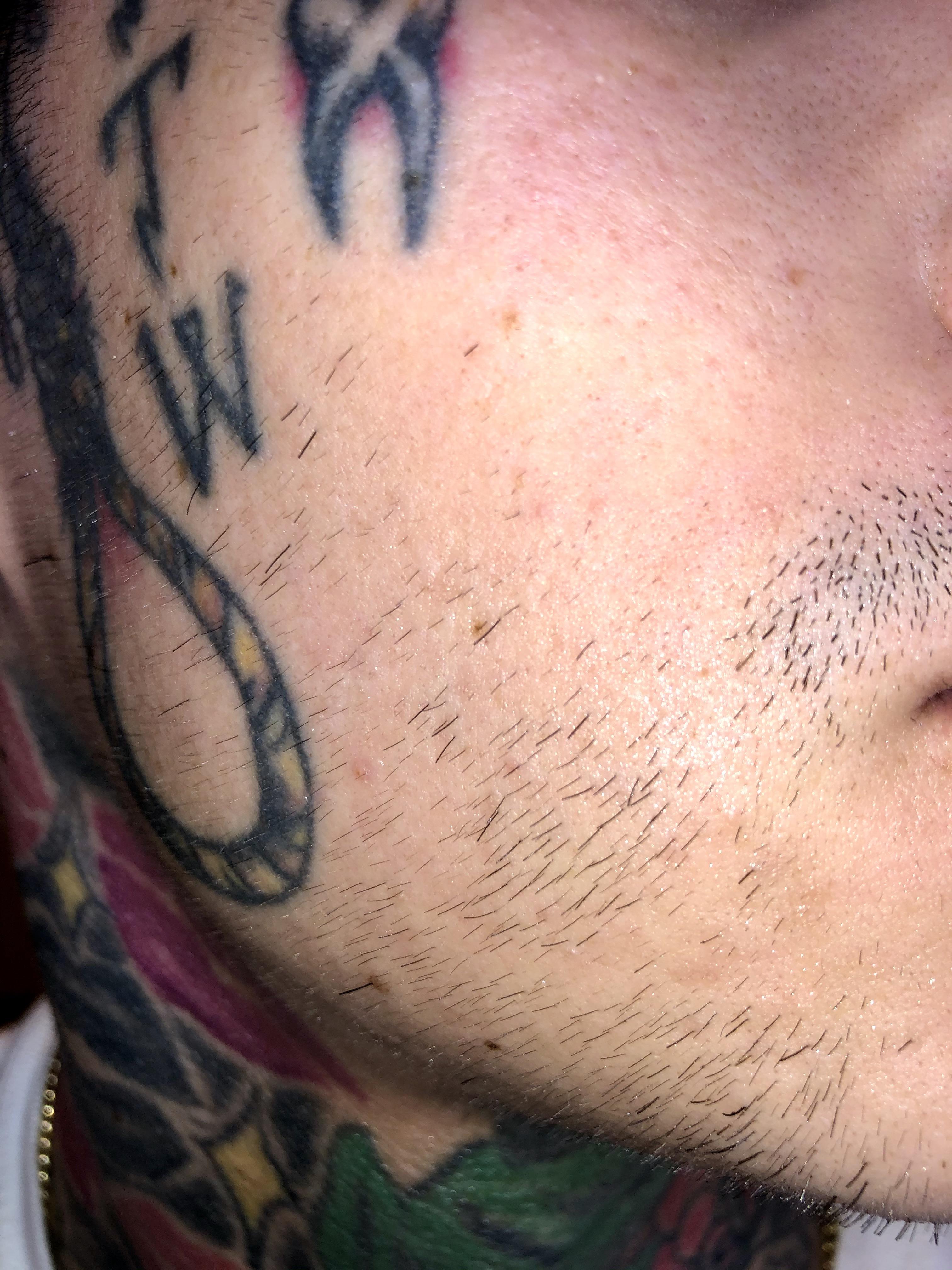 Would you define these as transitional hairs? 9 weeks in started with