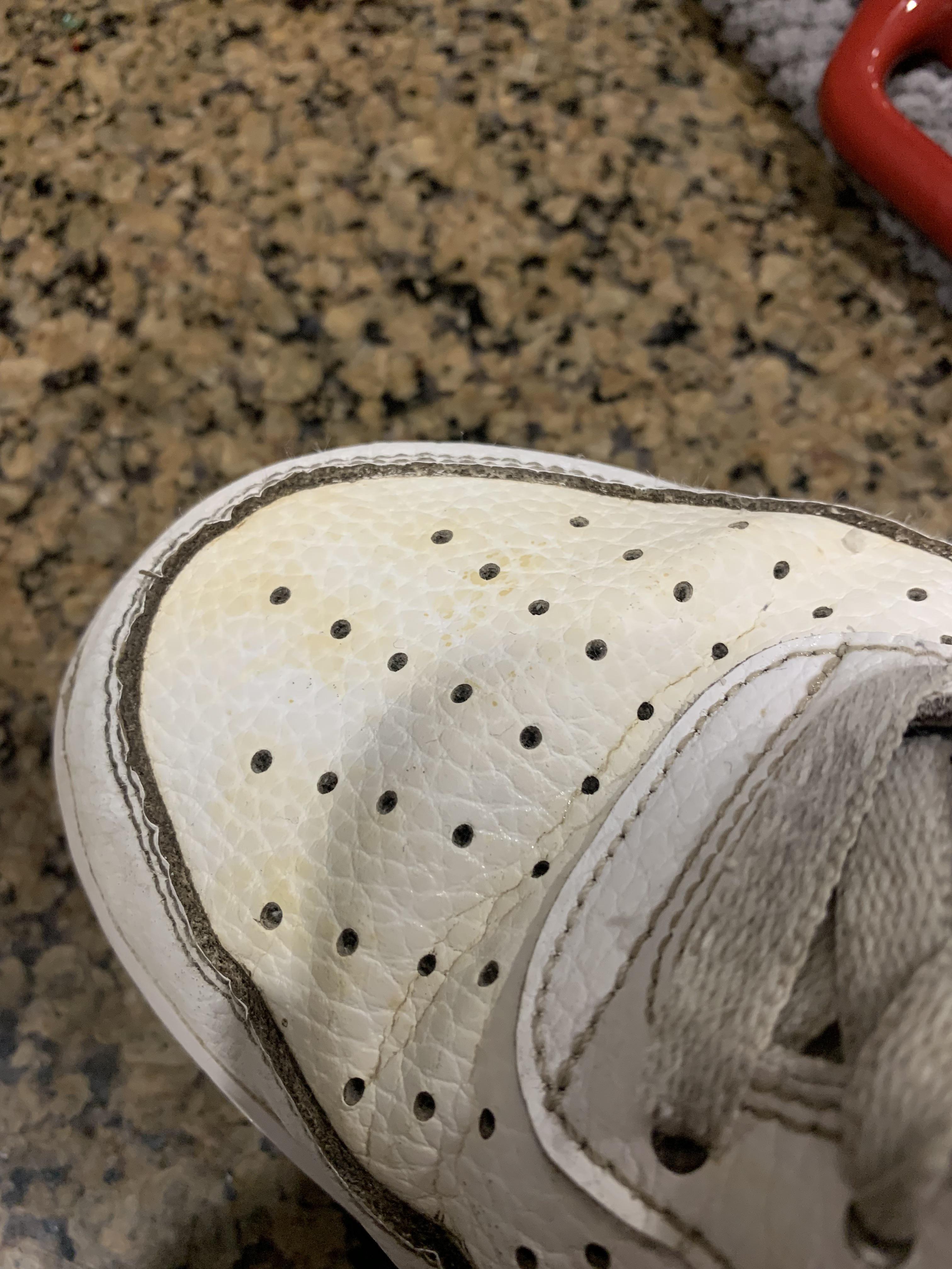 How can I get this yellowing/darkening off of my shoe? Magic Eraser