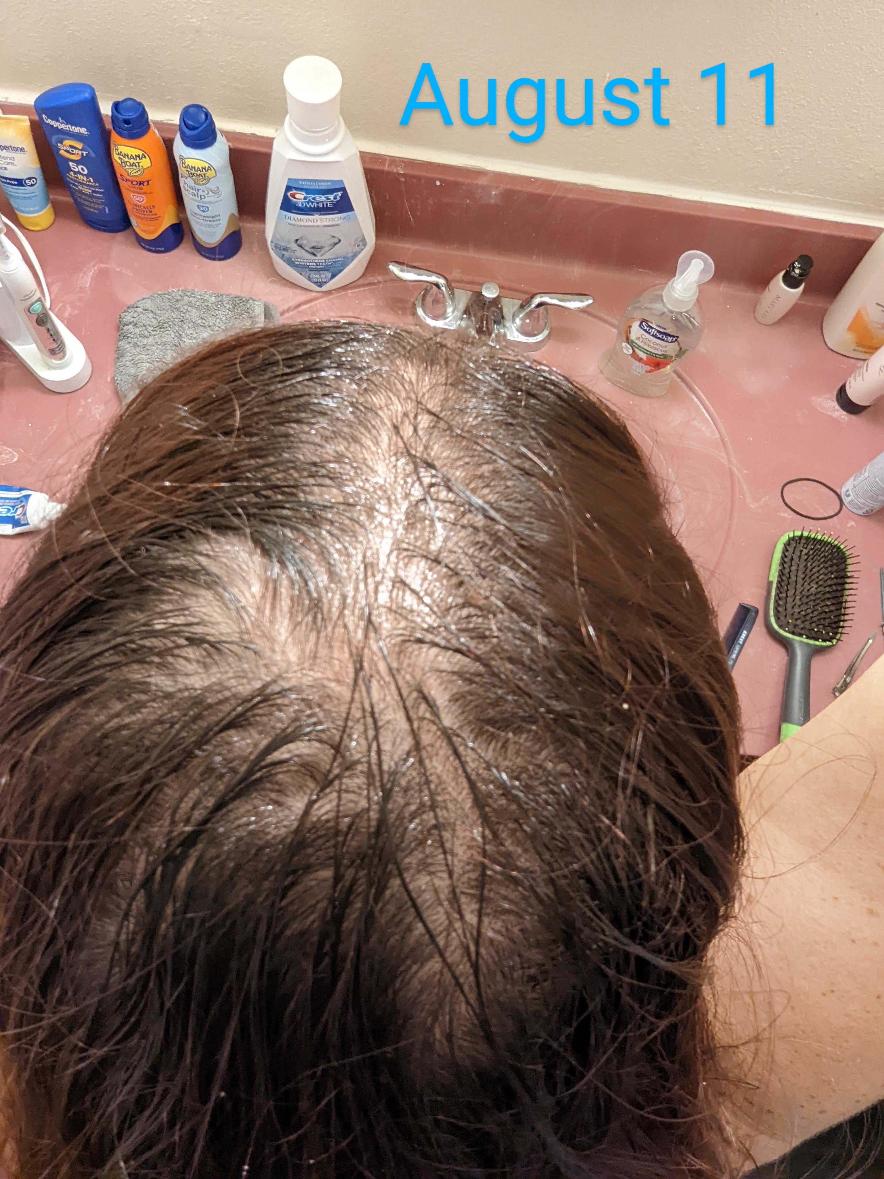 mielle rosemary oil Reddit post and comment search SocialGrep