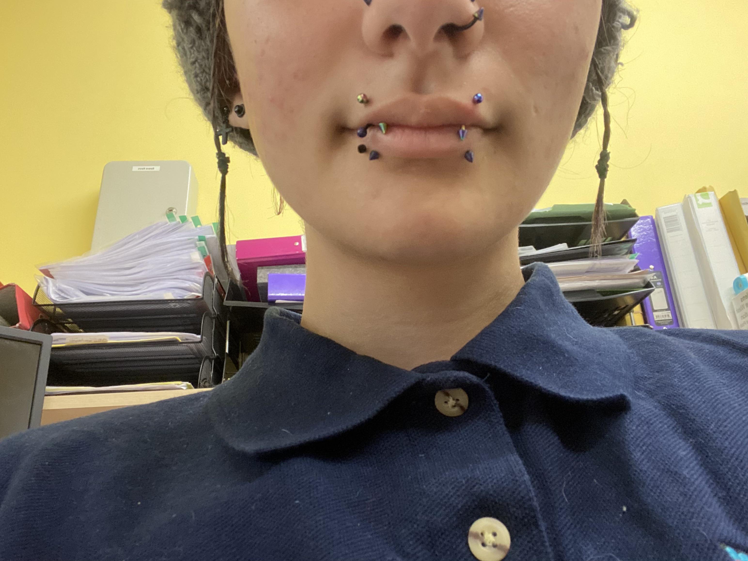 finally caved and added vertical angel bites to my lip set up, not sure