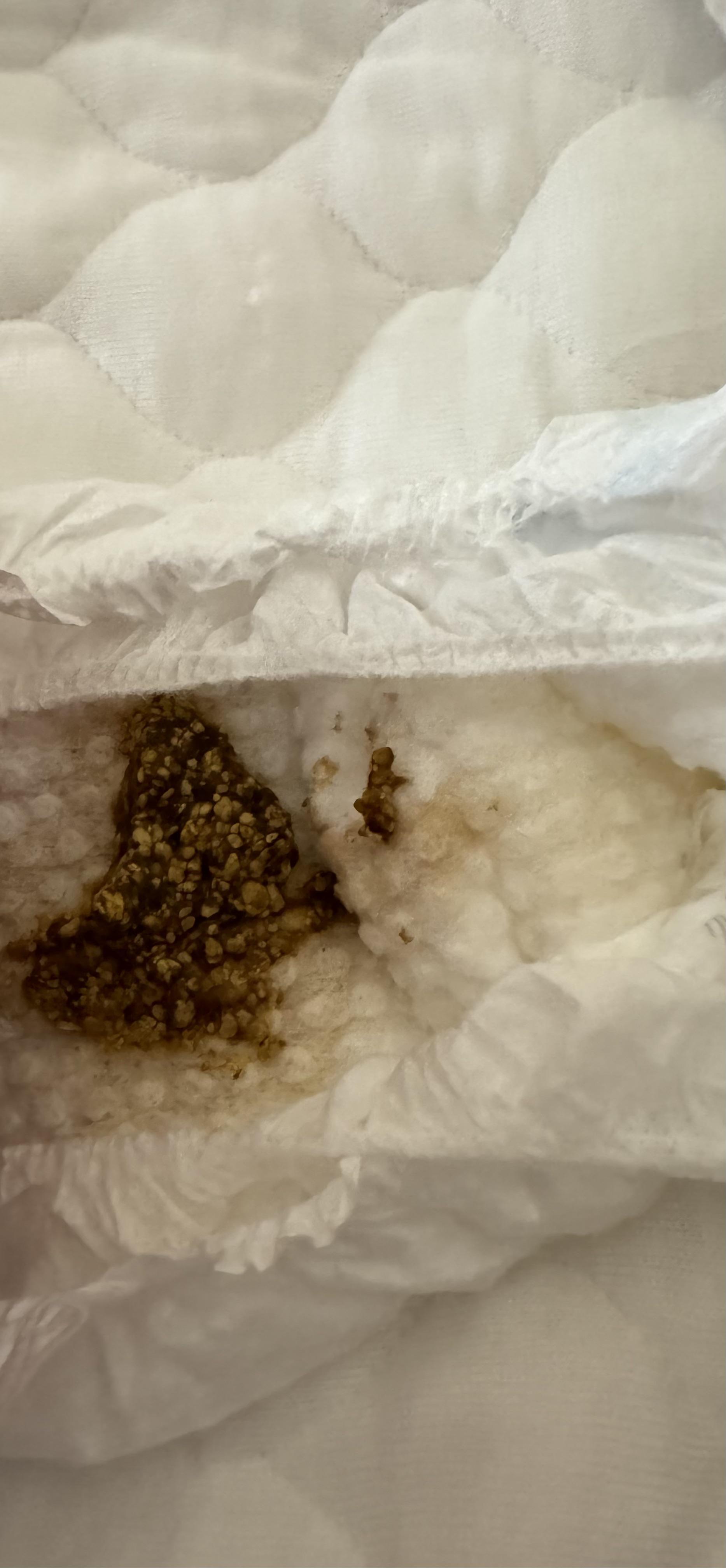 Is this poop normal for a two day old? Looks like crushed nuts. She’s