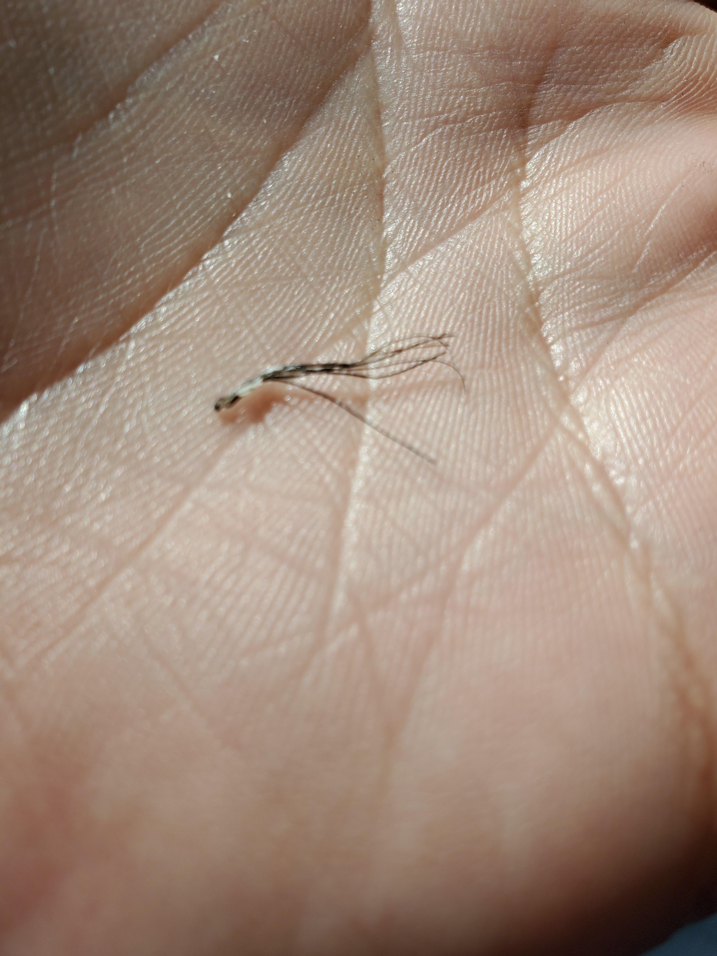 This sub seems to like ingrown beard hairs too. r/popping