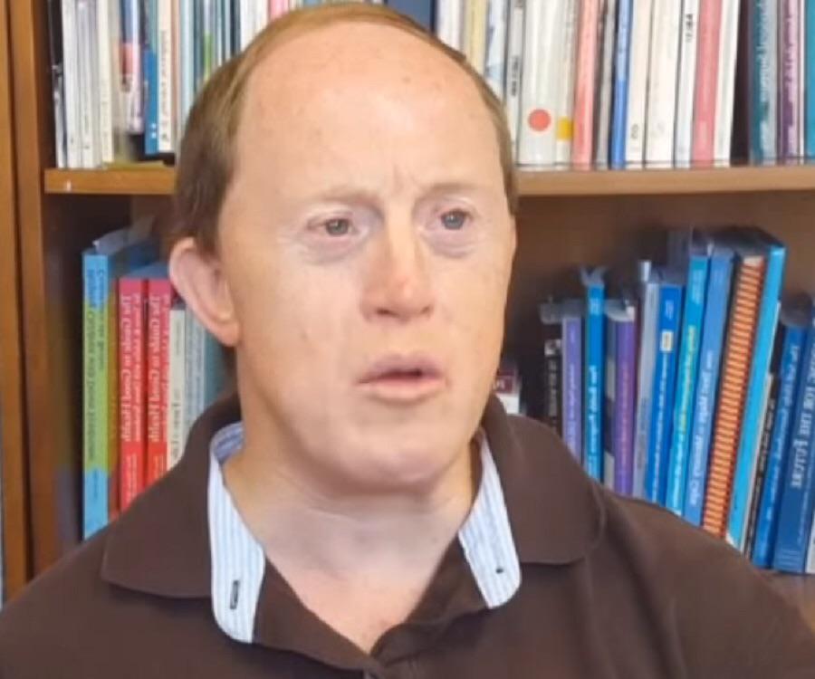 Chris Burke is an American Down syndrome advocate. Formerly, he was an