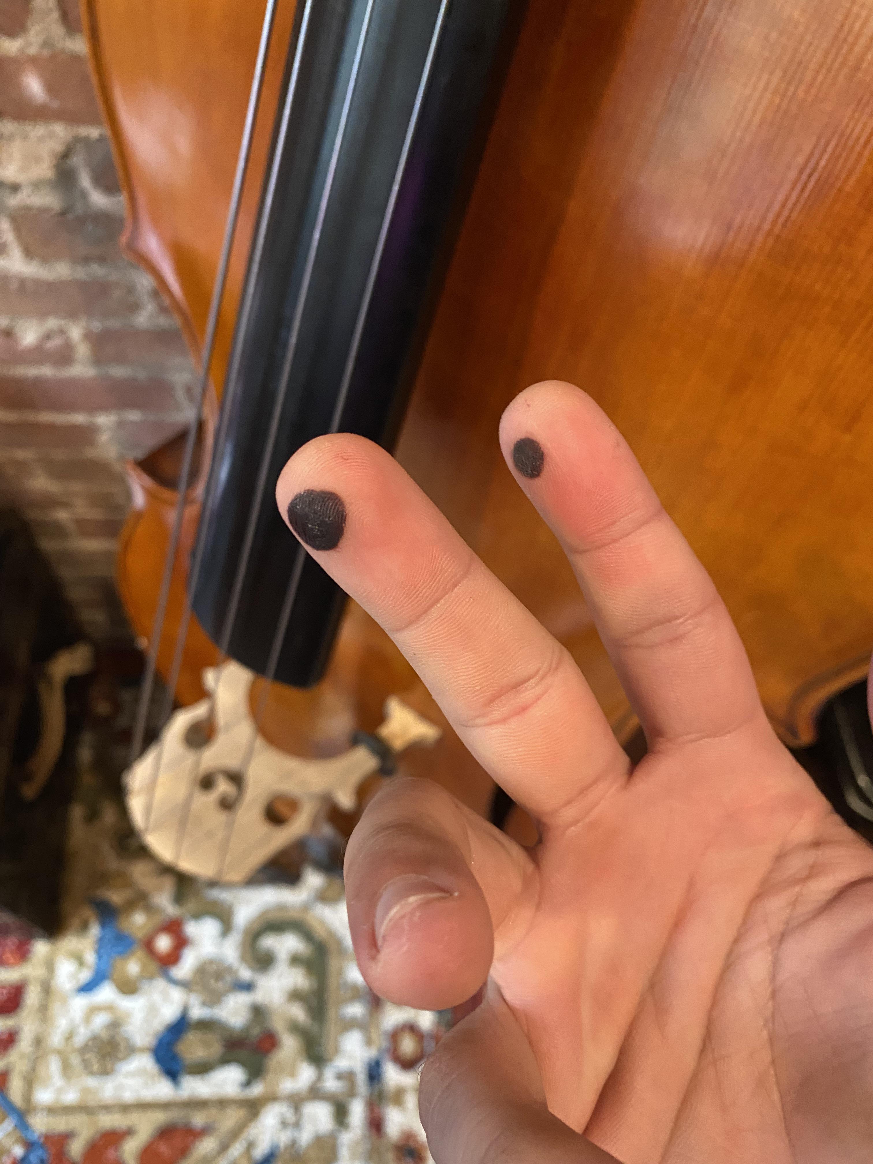 This happen to anyone else after long sessions. ? I play bass everyday