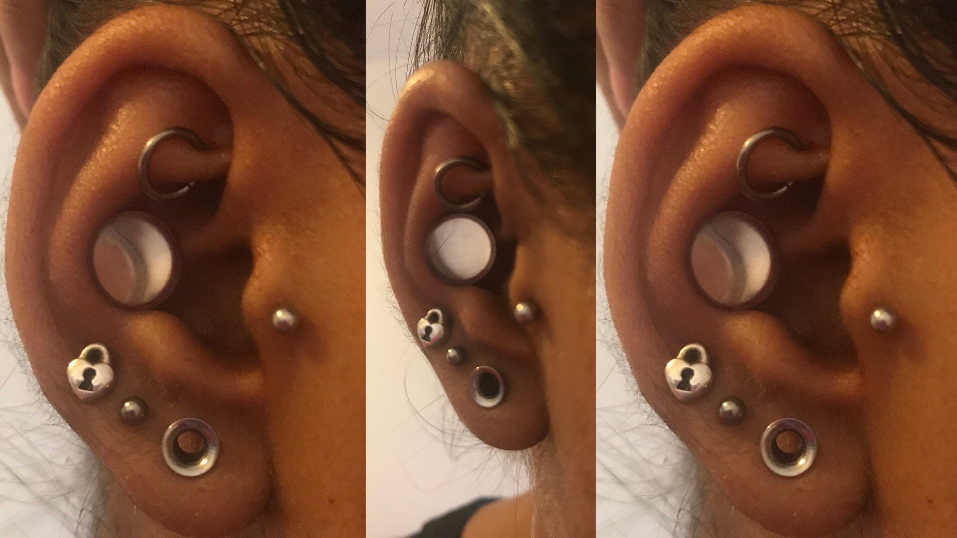 I got my conch punched! Punched out a problematic conch piercing with a