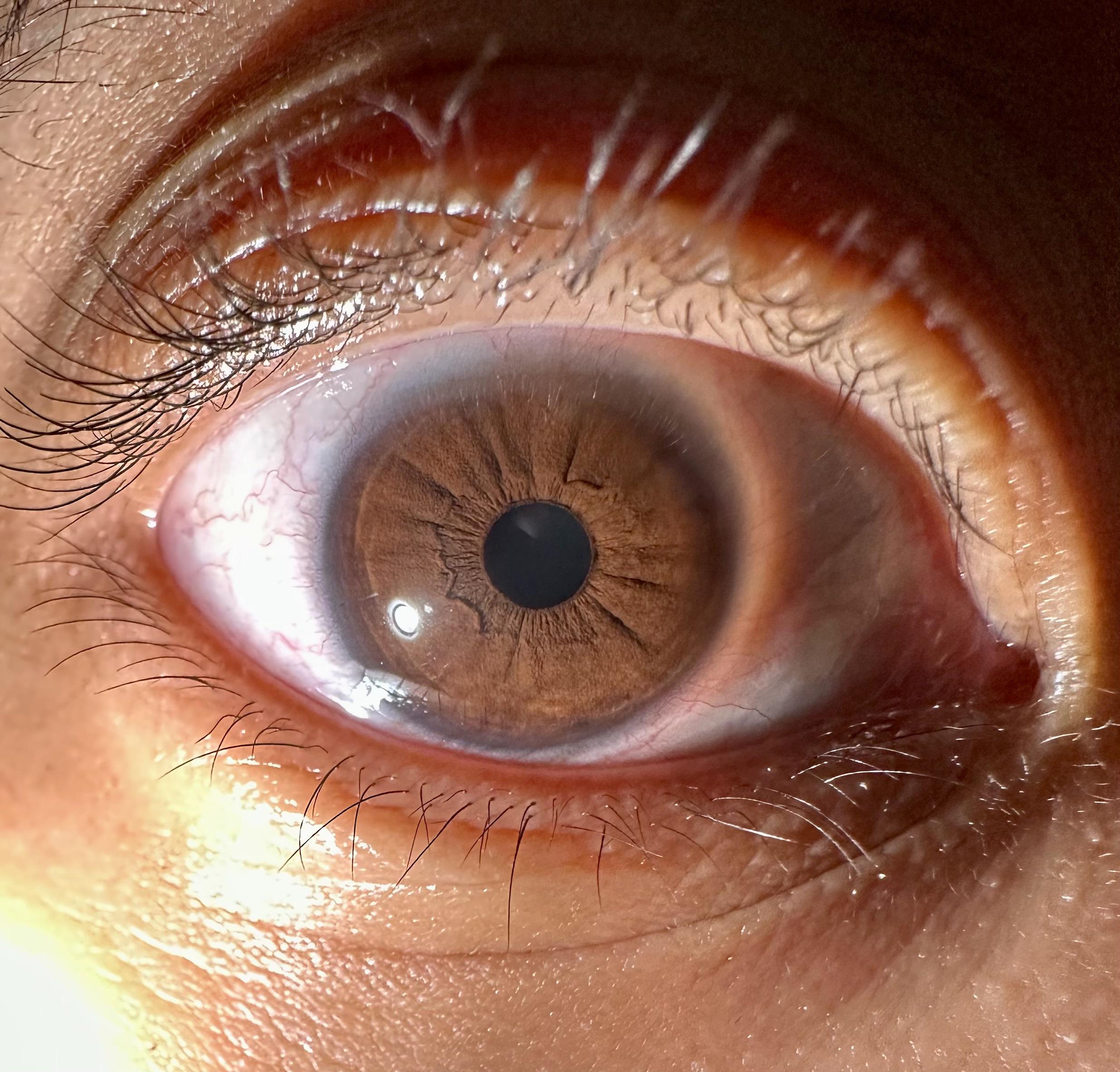 Brown eyes under a flashlight r/eyes