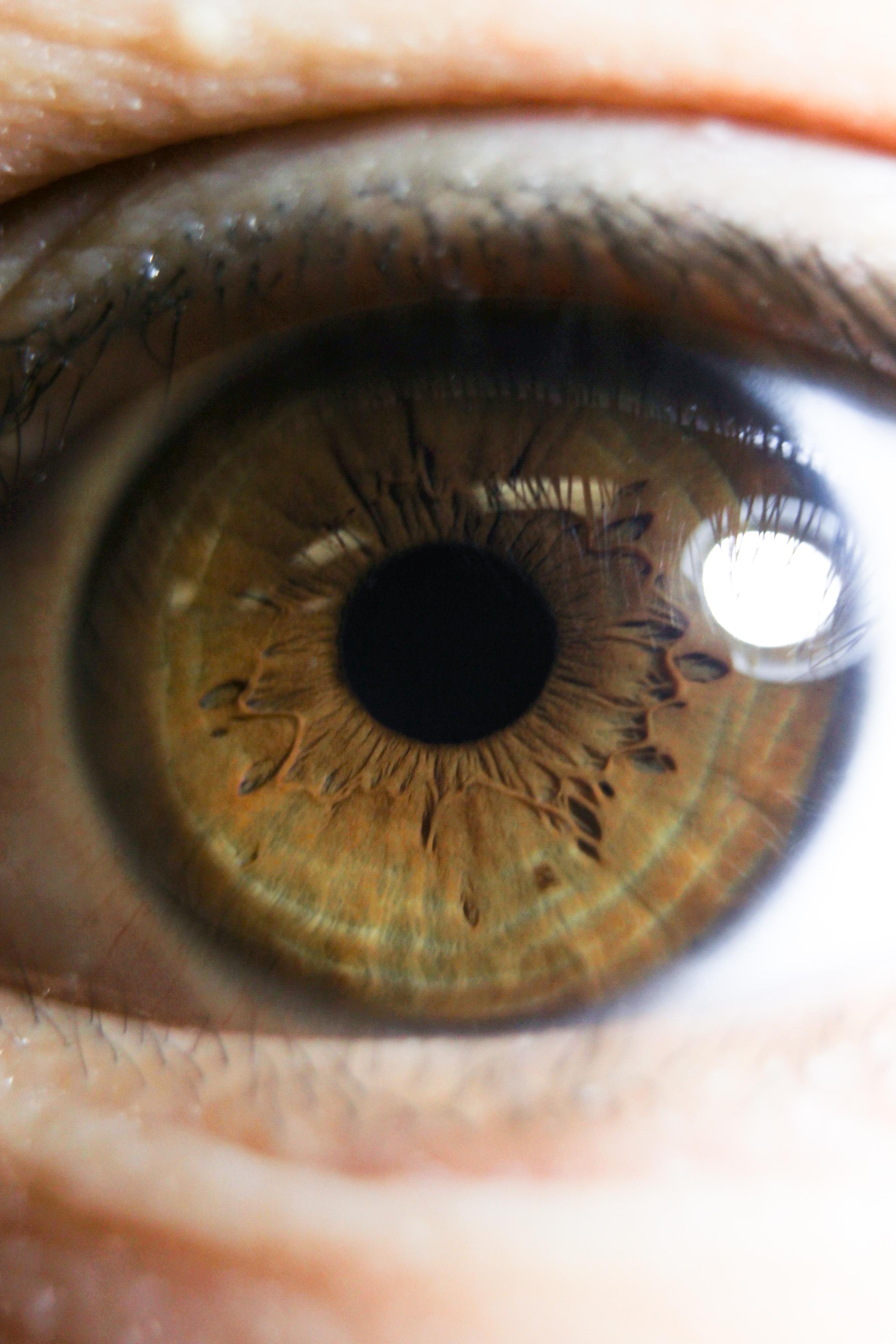 Can anyone explain what is going on with the ripples in my eye? r/eyes