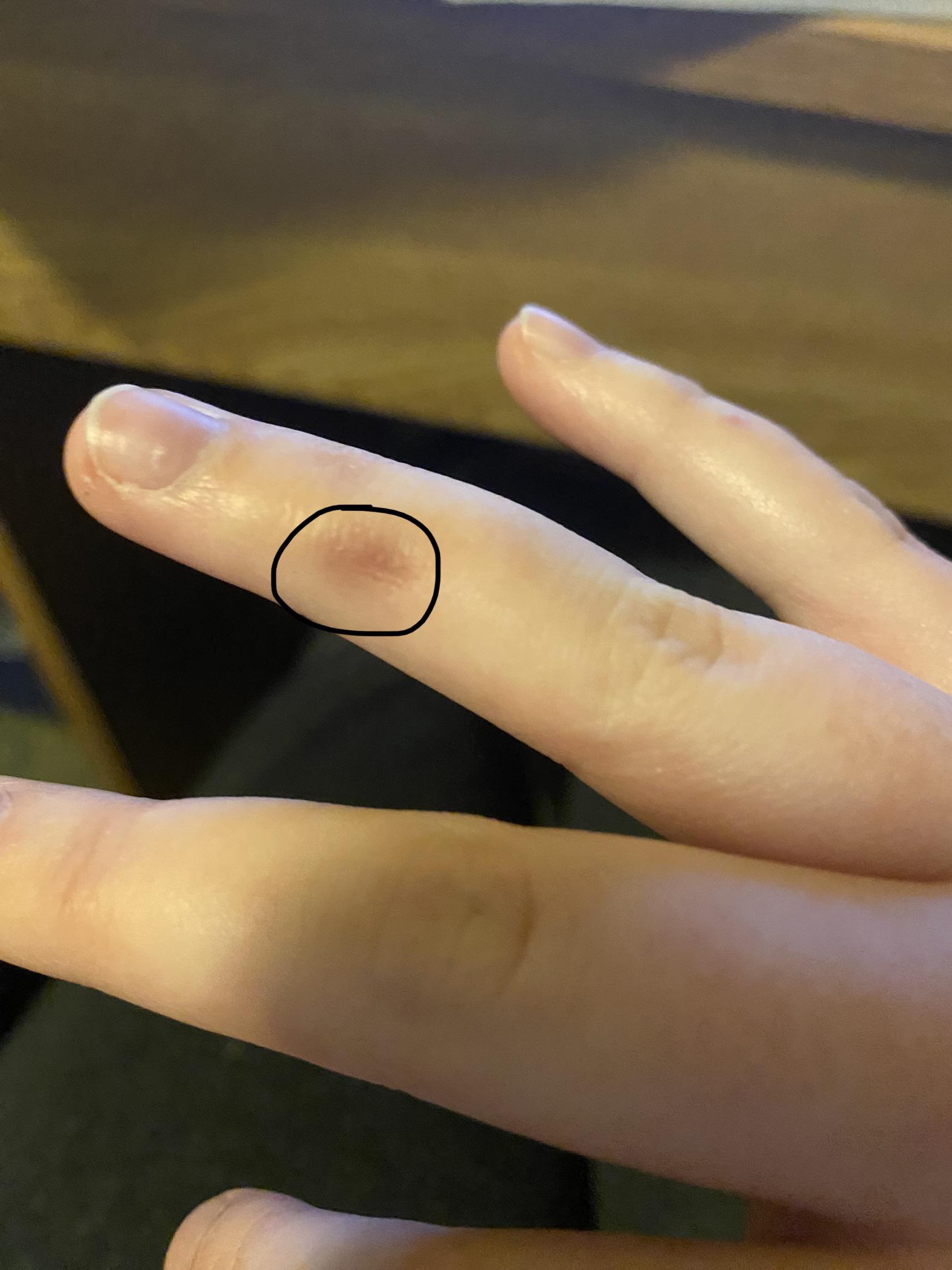 how to hold a pen without bruising? or bothering joints? (my finger