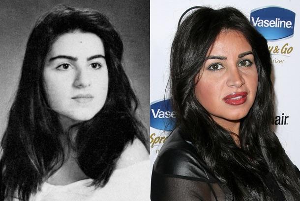 It's amazing what a nose job can do! Before & After of my girl MJ