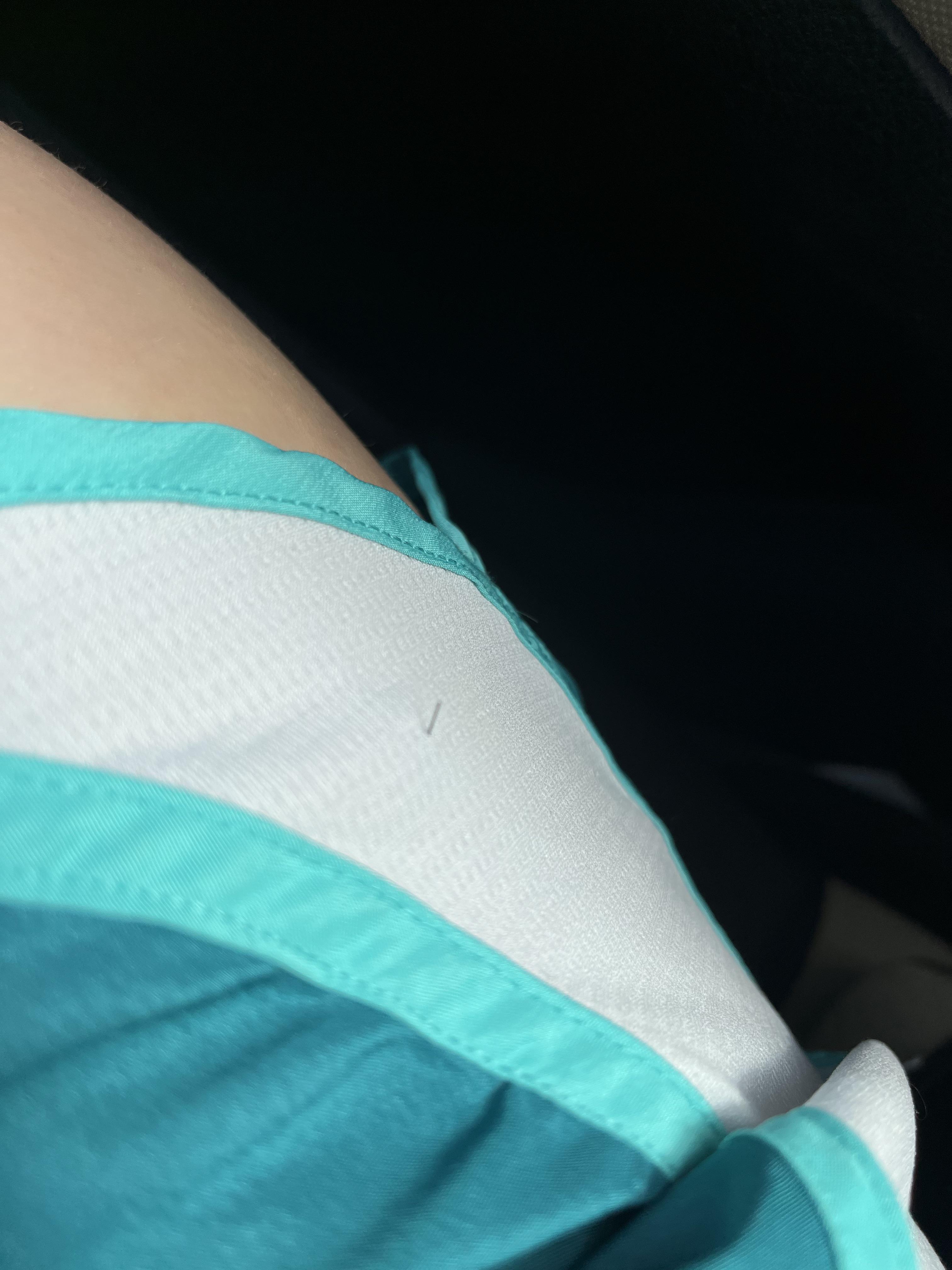 I had surgery the other day. Today I tried to pull this “leg hair” that was sticking through my