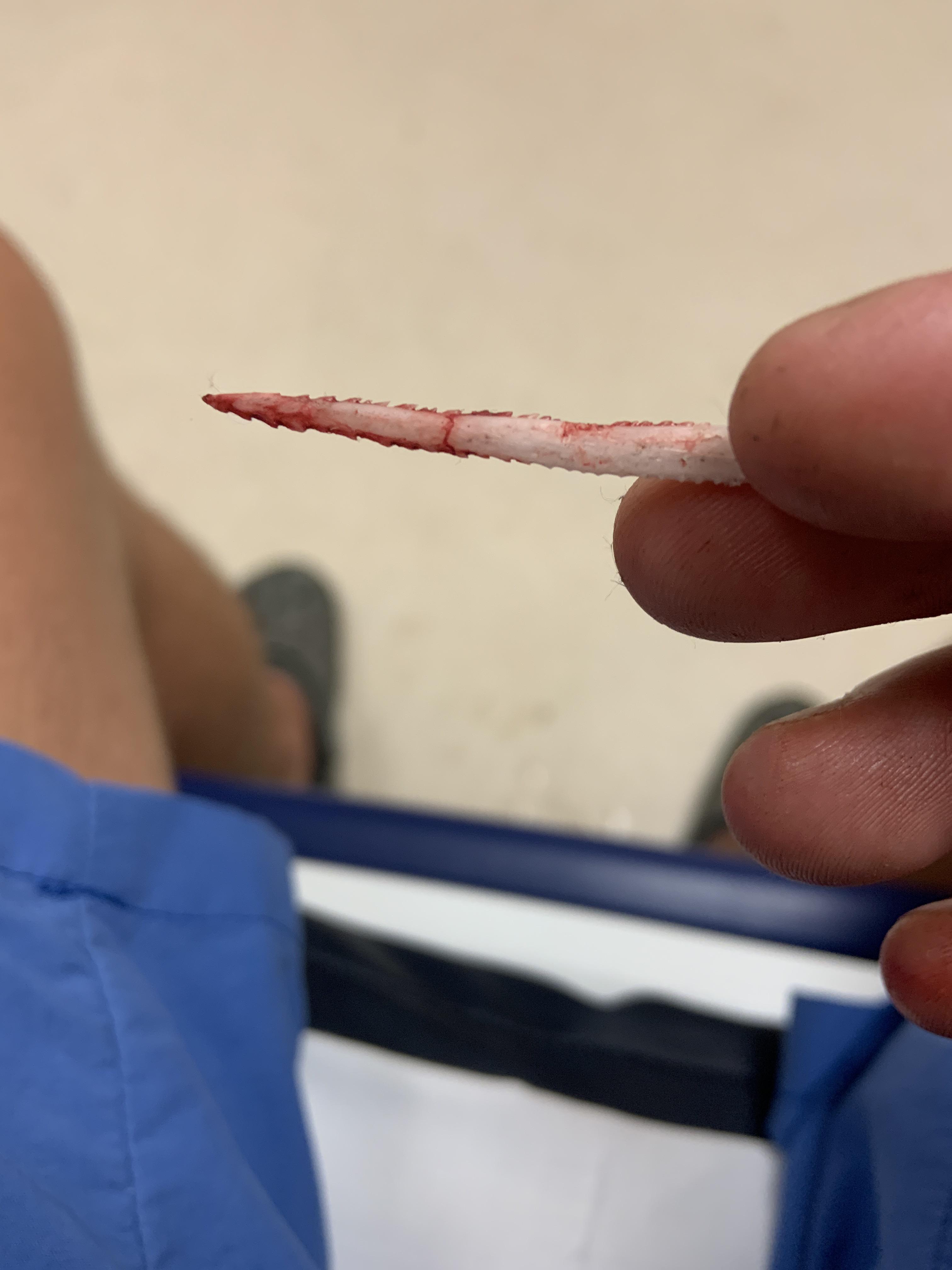 Got barbed by a catfish tonight, close up pic of the barb! The edge is