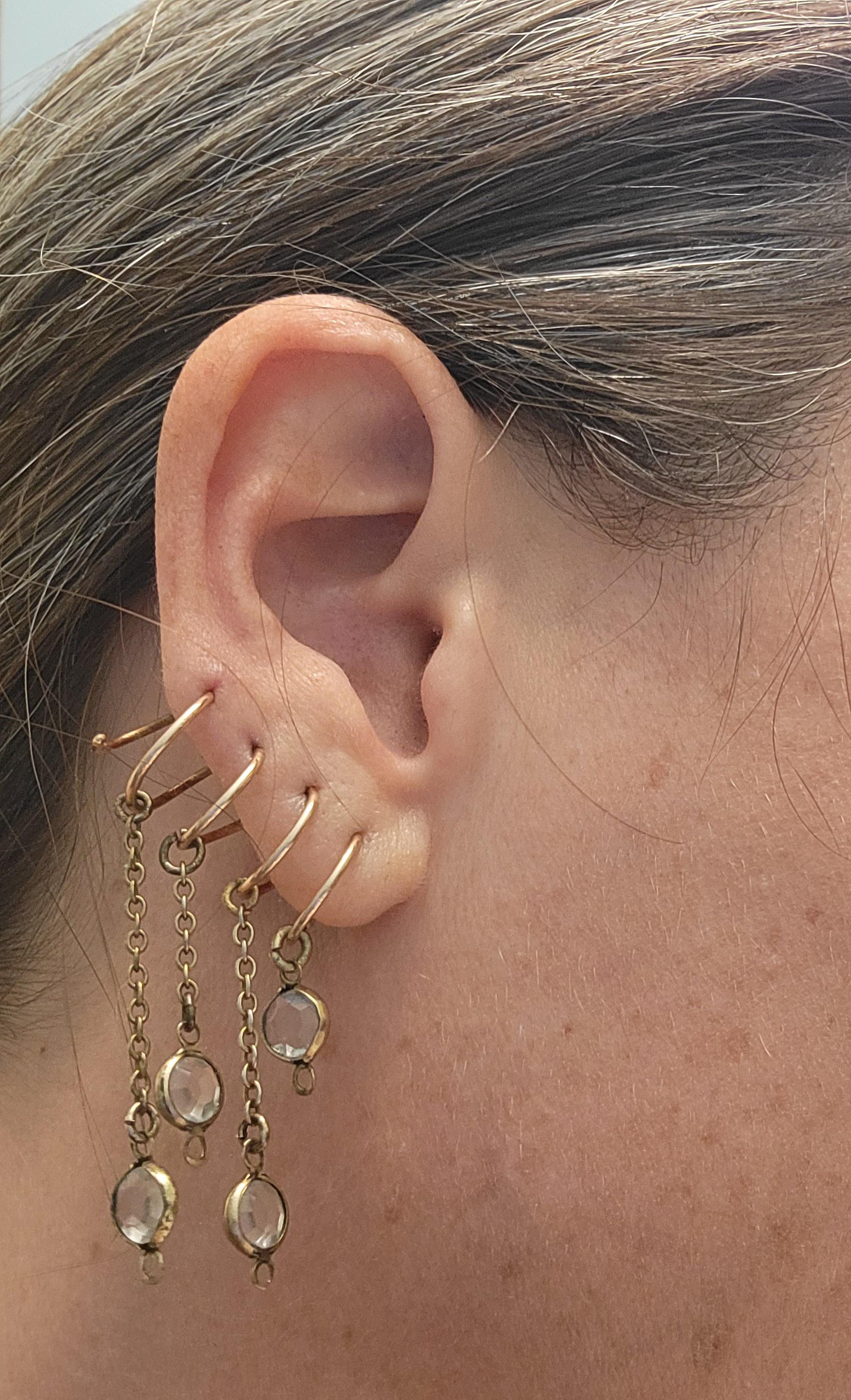 1 best u/fandragon images on Pholder After months of soreness and