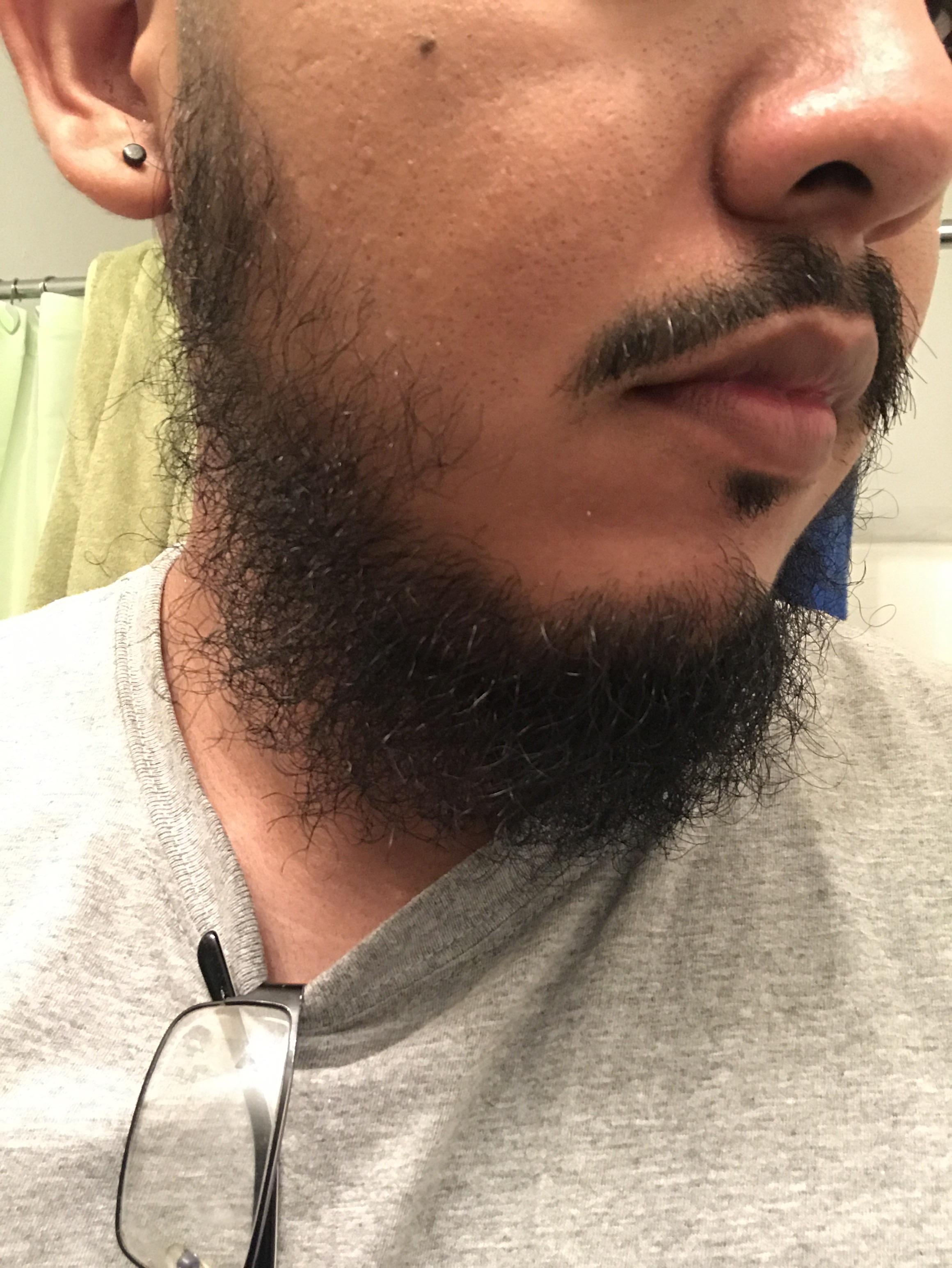 I need help with my beard. It's patchy and I need some ideas for some