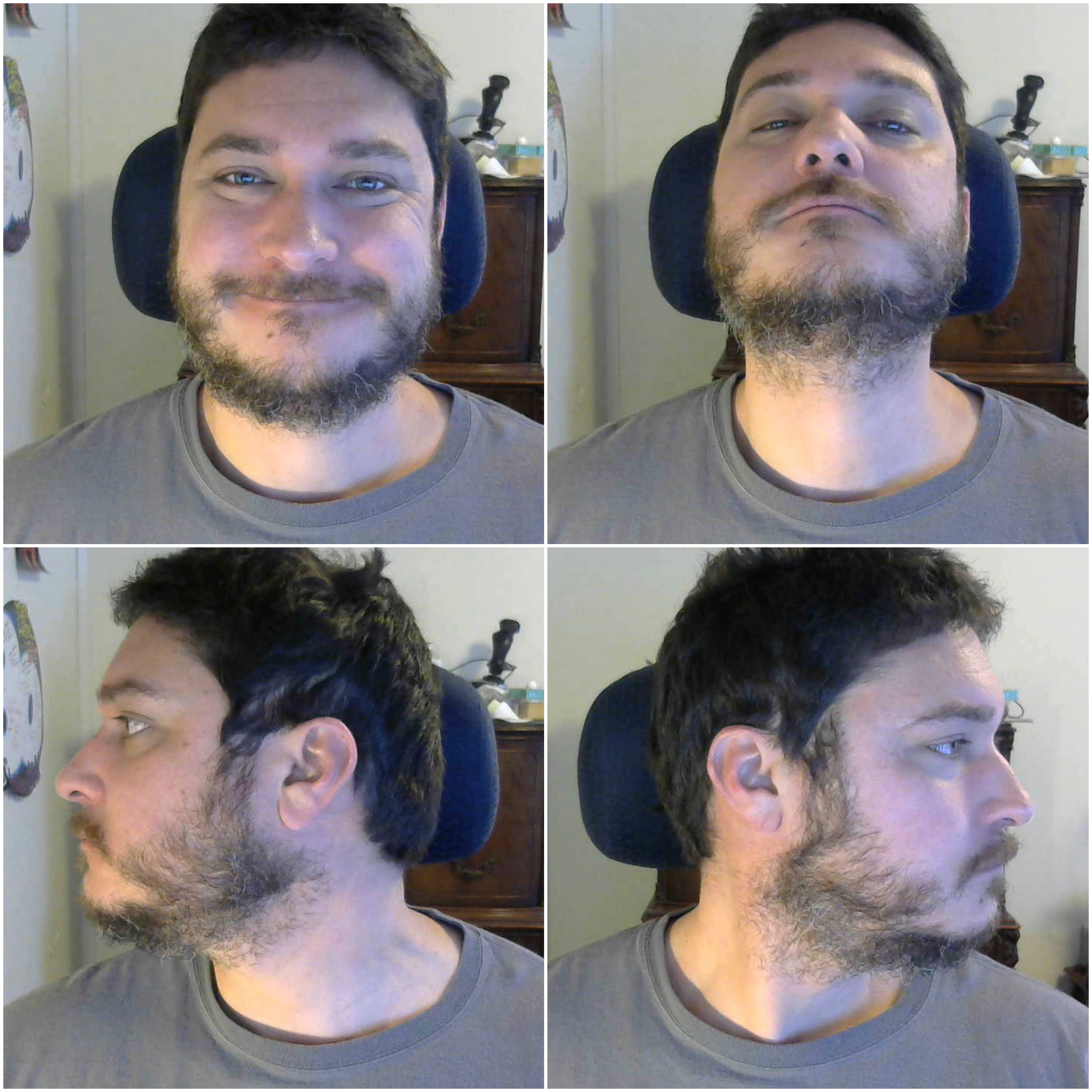 Facial hair pattern won't let me grow a glorious beard. Don't want to