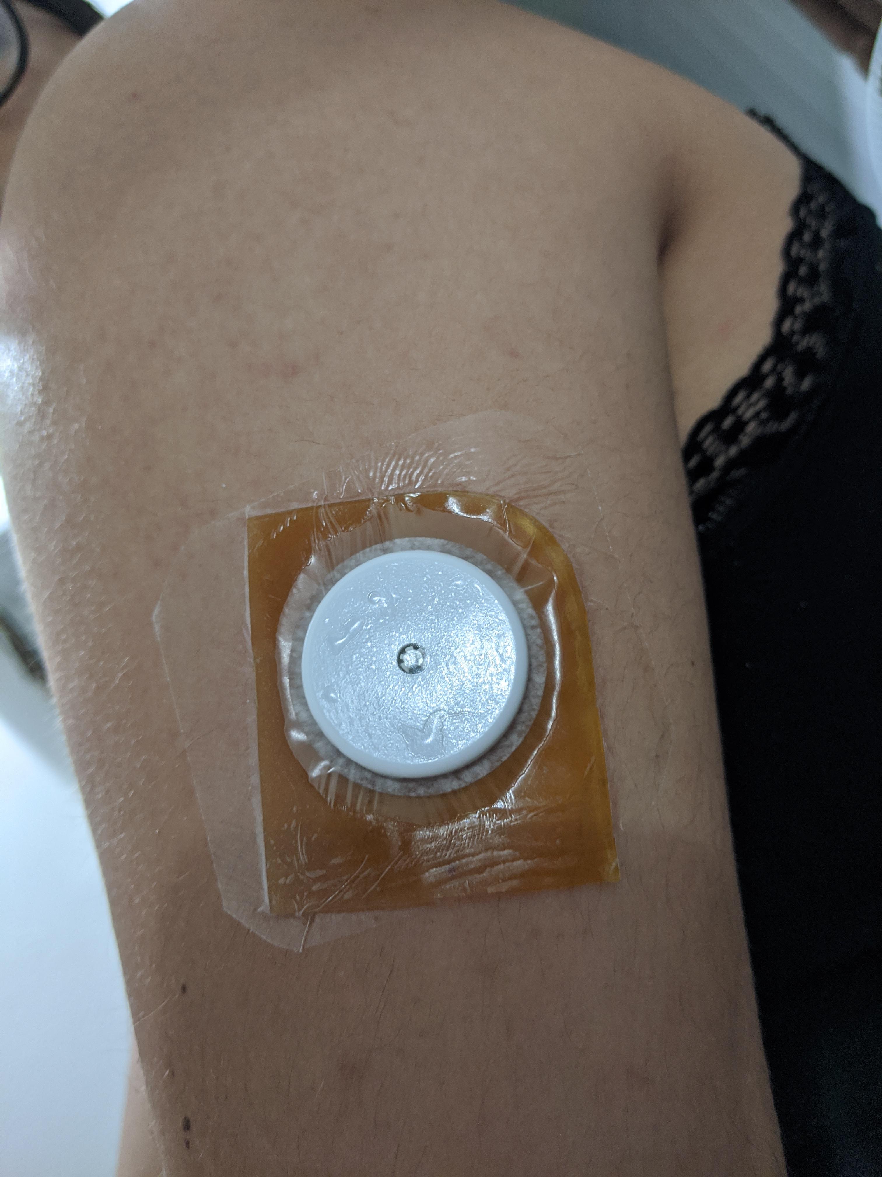 I get a rash from the FSL adhesive so I hadn't been able to use the