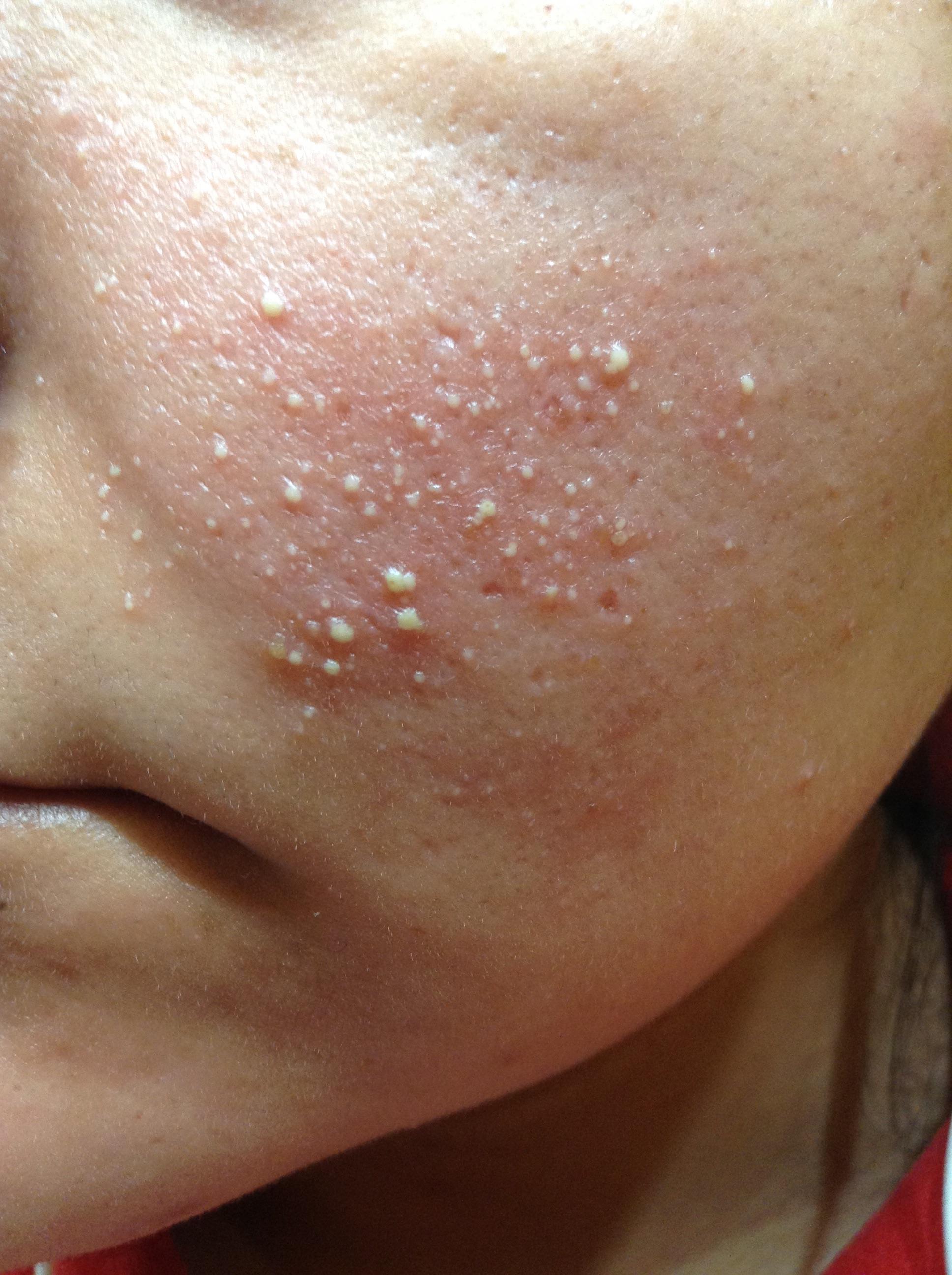 what is this and how do i get rid of it? and don’t say they’re just