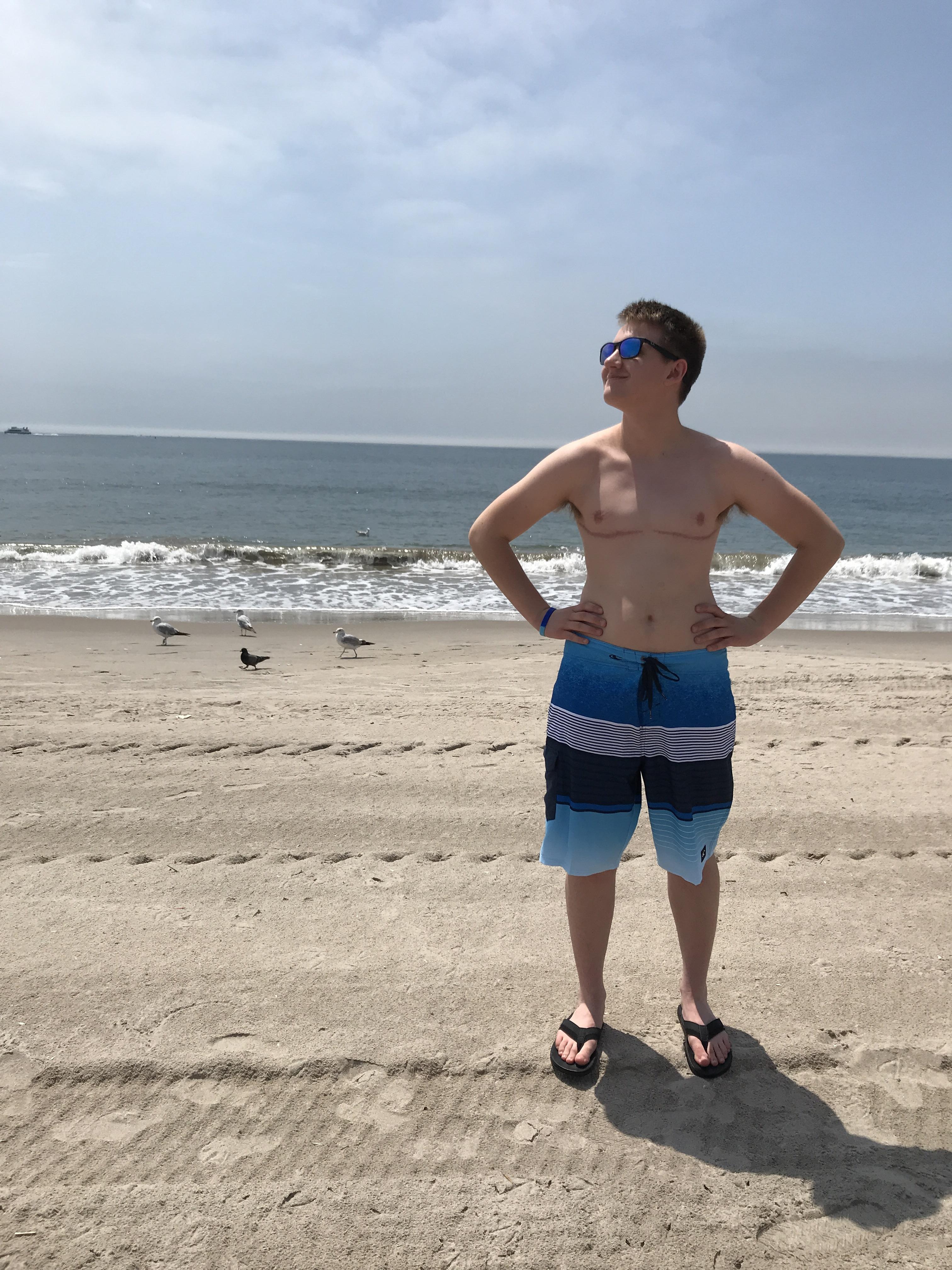 got to be shirtless in public for the first time ever today! r/ftm