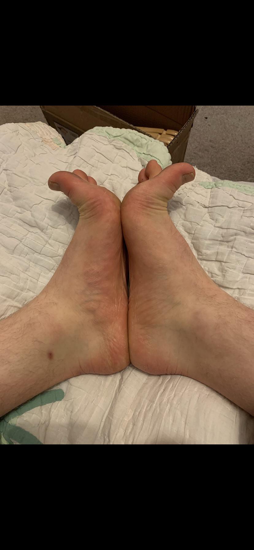 Pain in the shin bone FootFunction