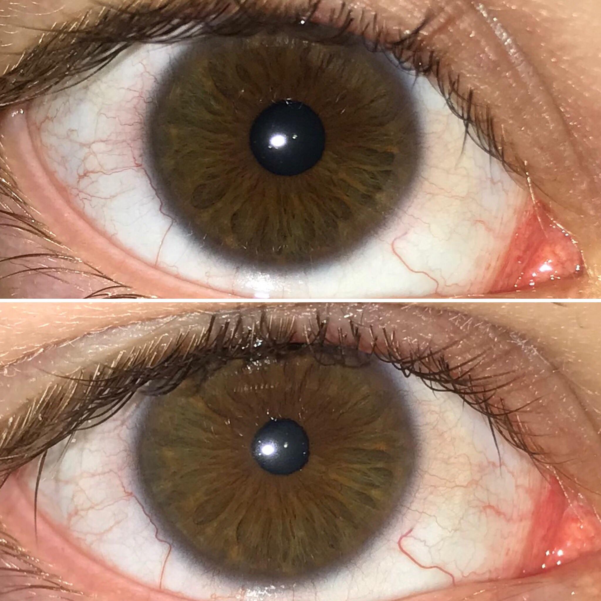 My eyes used to be flat mediumbrown and changed to