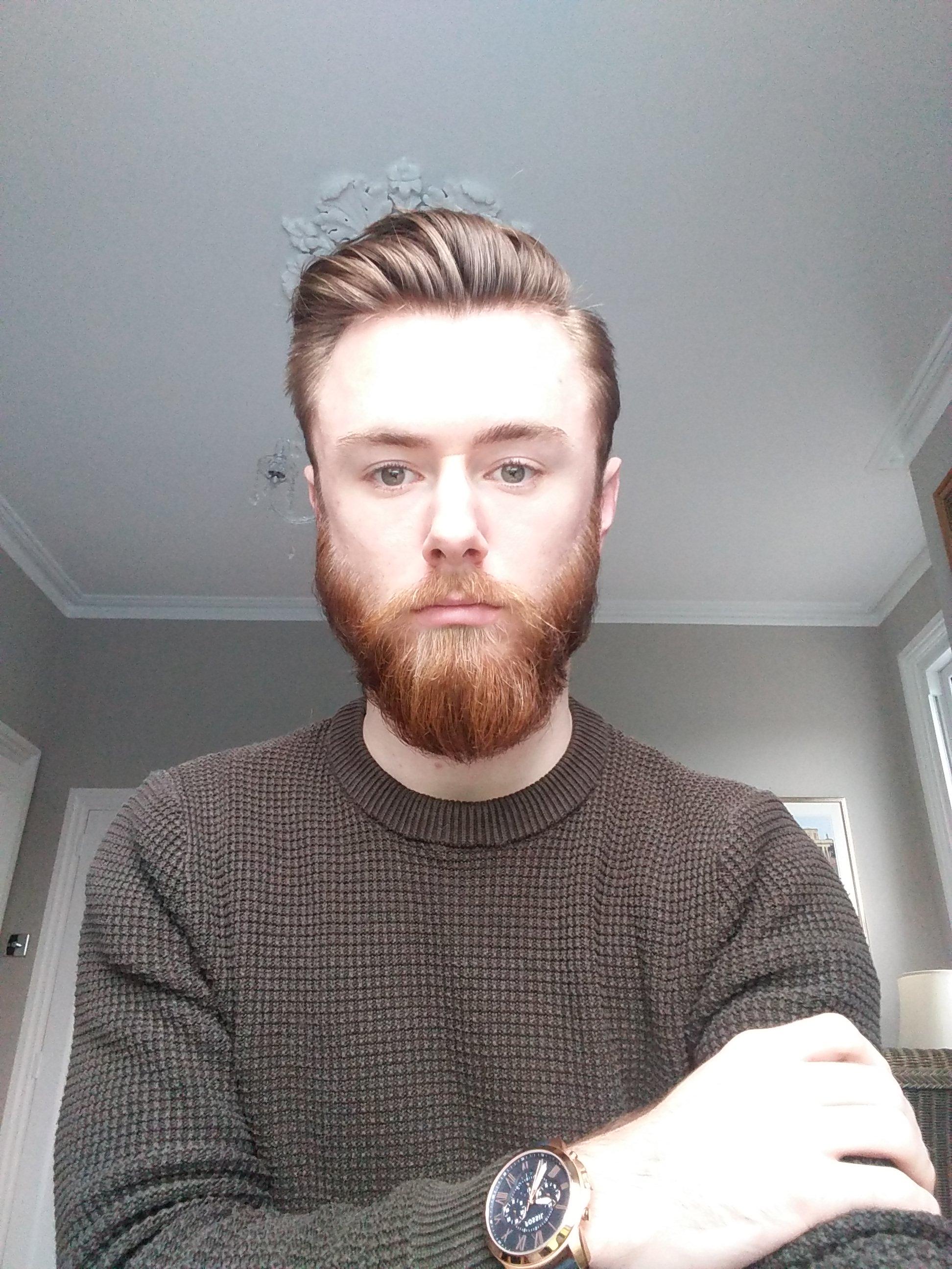 22yo, 5 months in. My beard naturally leans to one side because all the