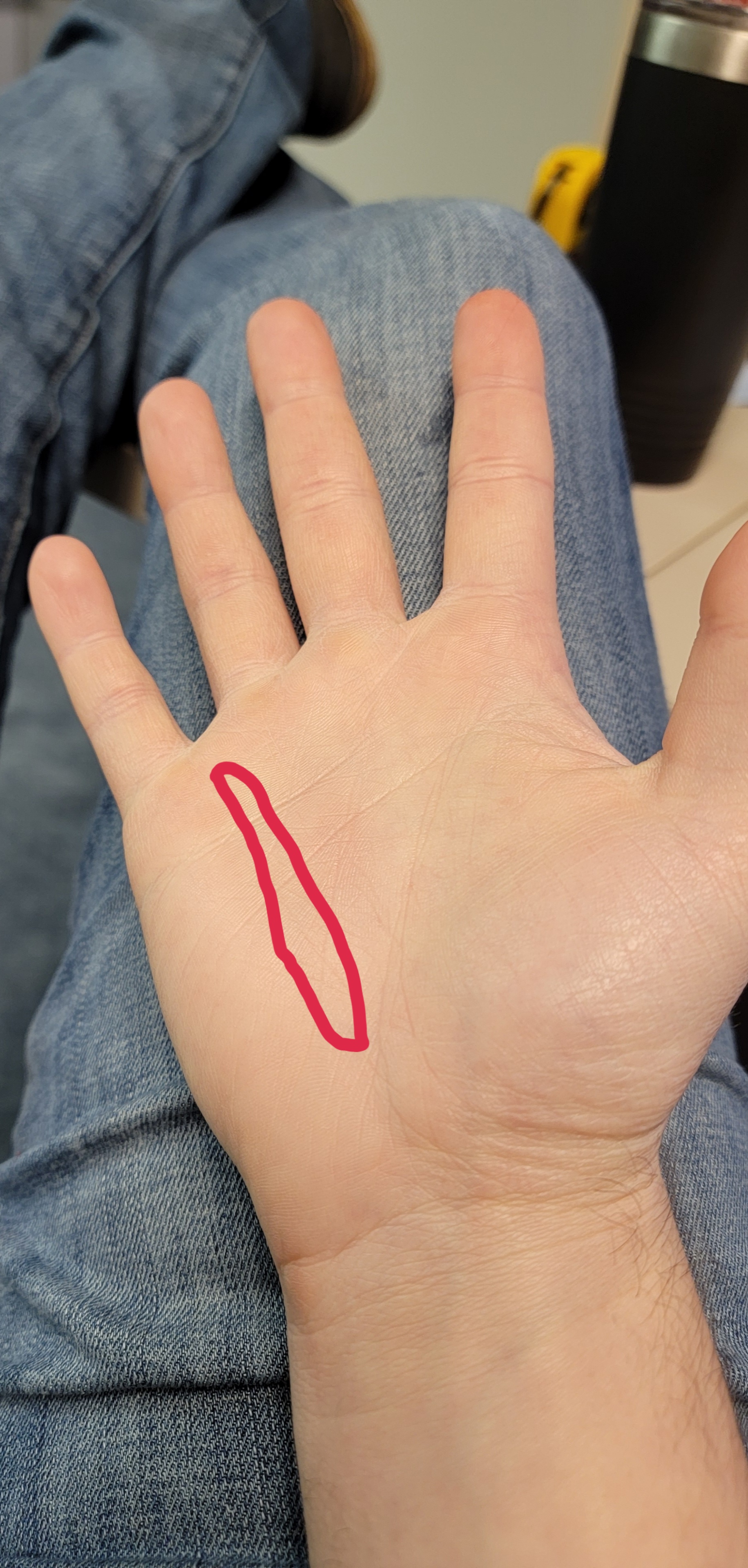 Inner hand pain (details in comment) r/Bowling