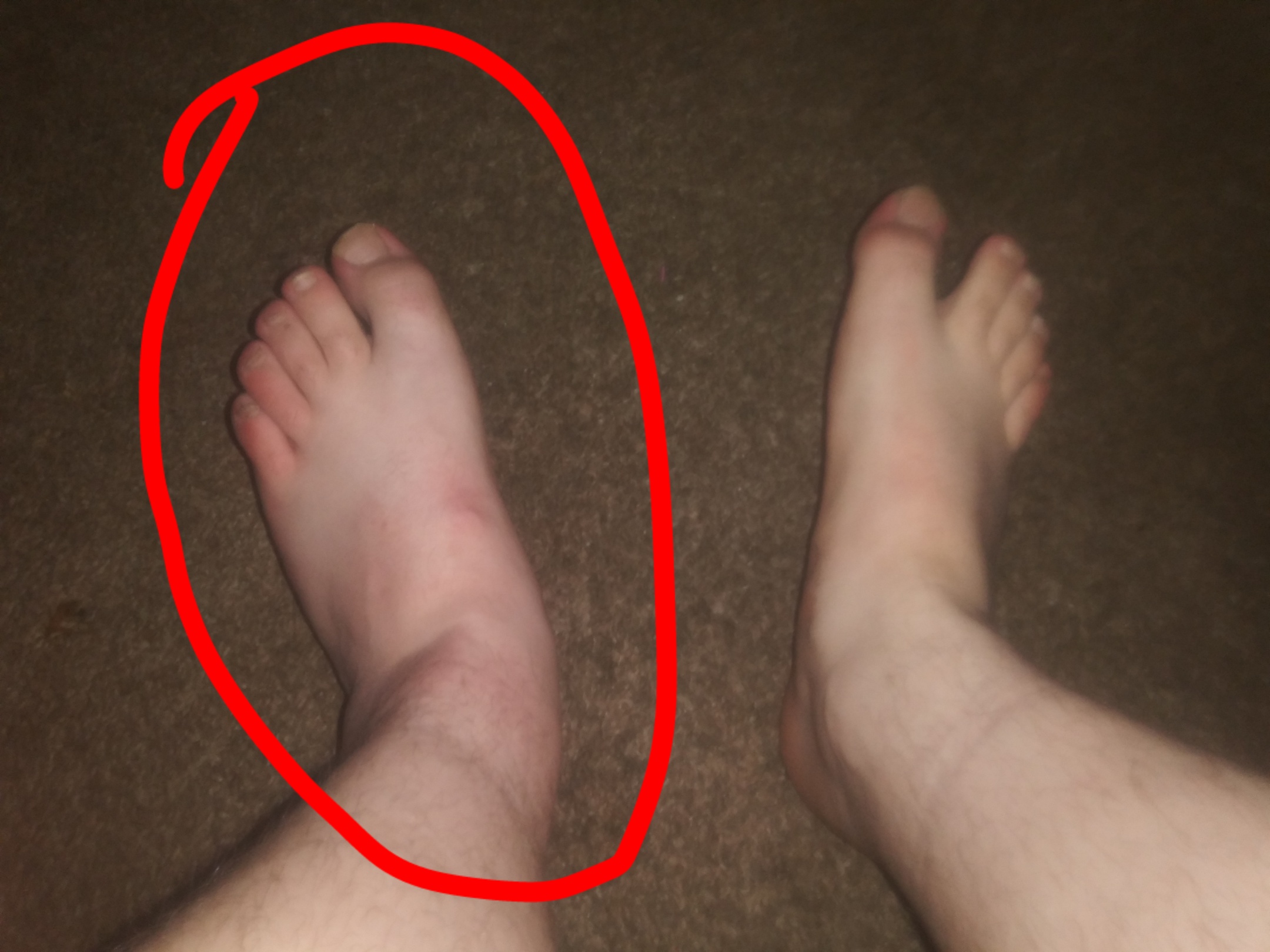 My foots been hurting for a while now and it looks out off place