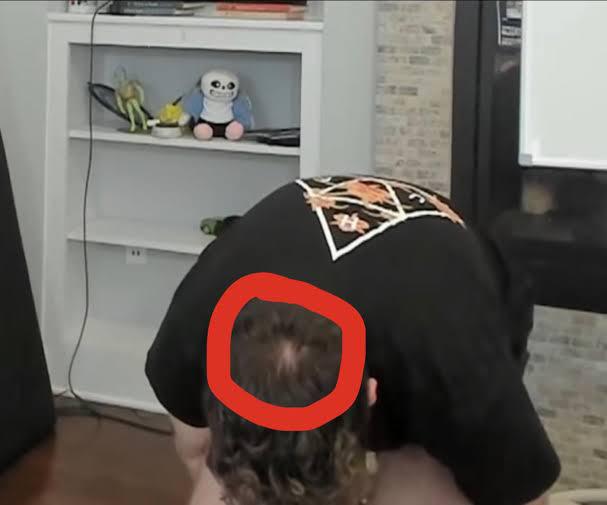 Sock for bald r/Socksfor1Submissions