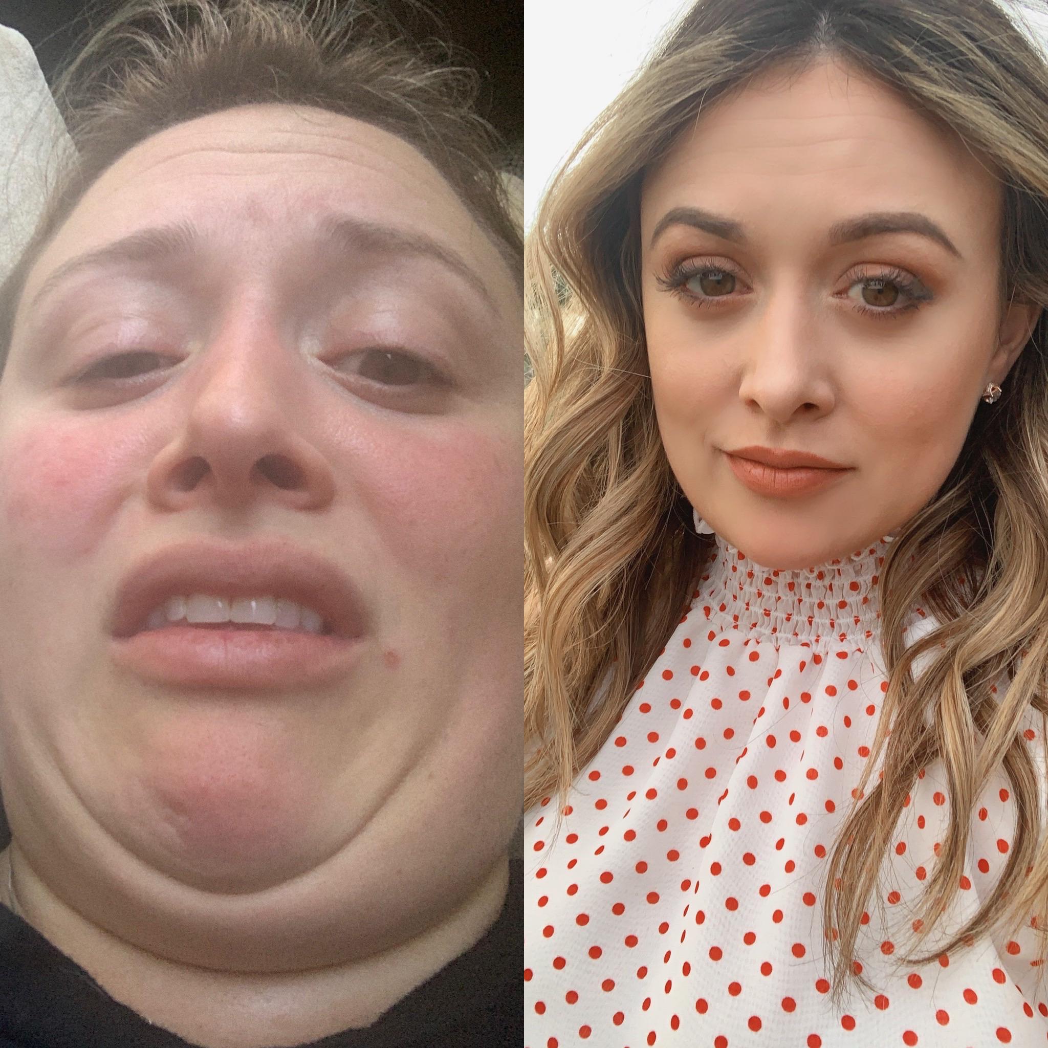 5963 best Ugly Face images on Pholder Pretty Girls Ugly Faces