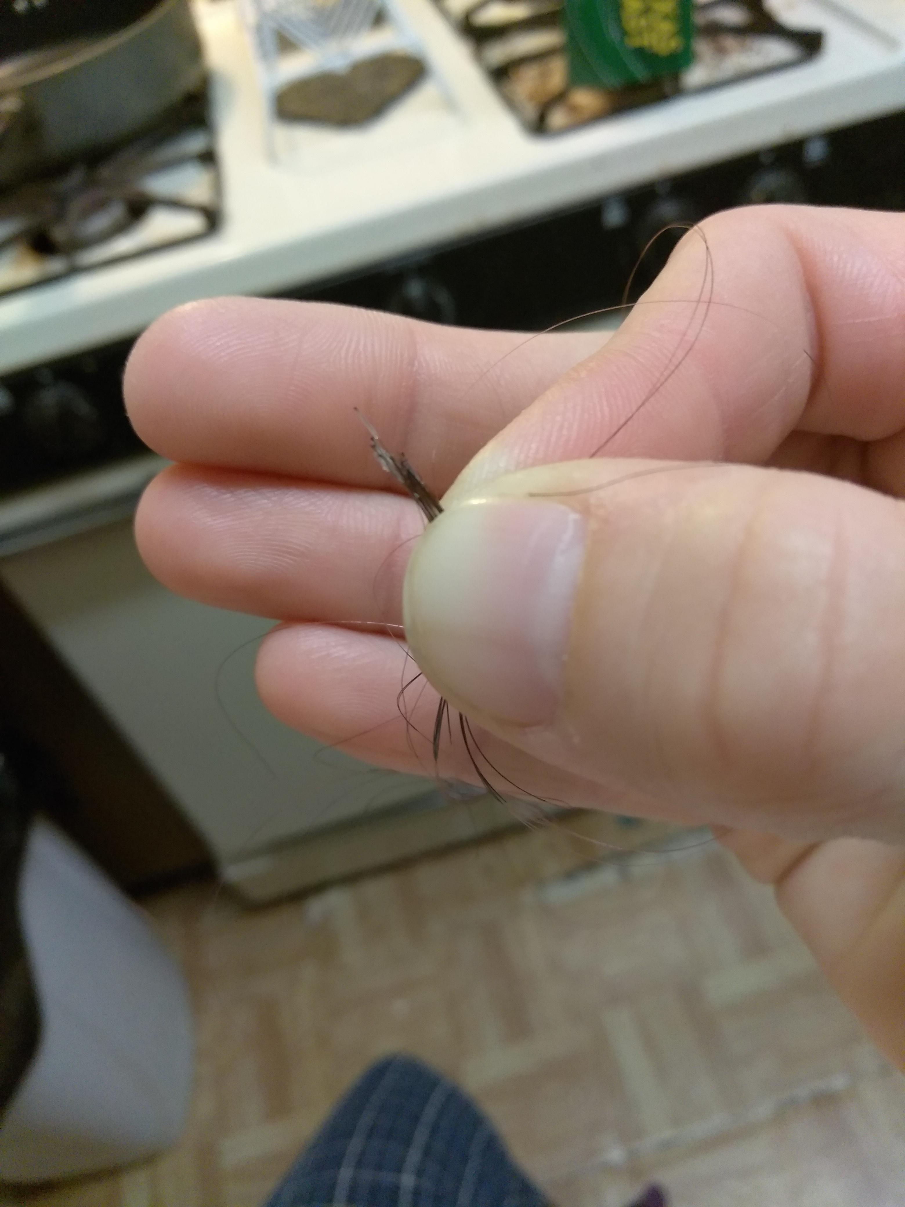 What is this stuff on my hairs i pulled out? r/Trichsters