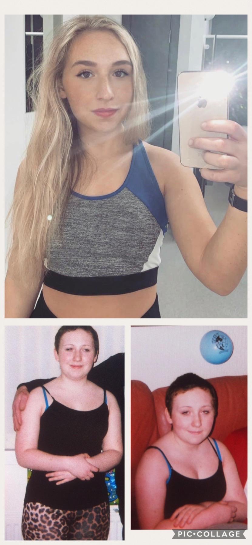 1 best u/c8h11no2addiction images on Pholder F/21/5’3” [160lbs