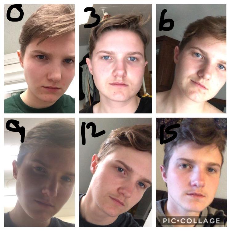 FTM 015 months HRT! Happier than ever, top surgery in December! r