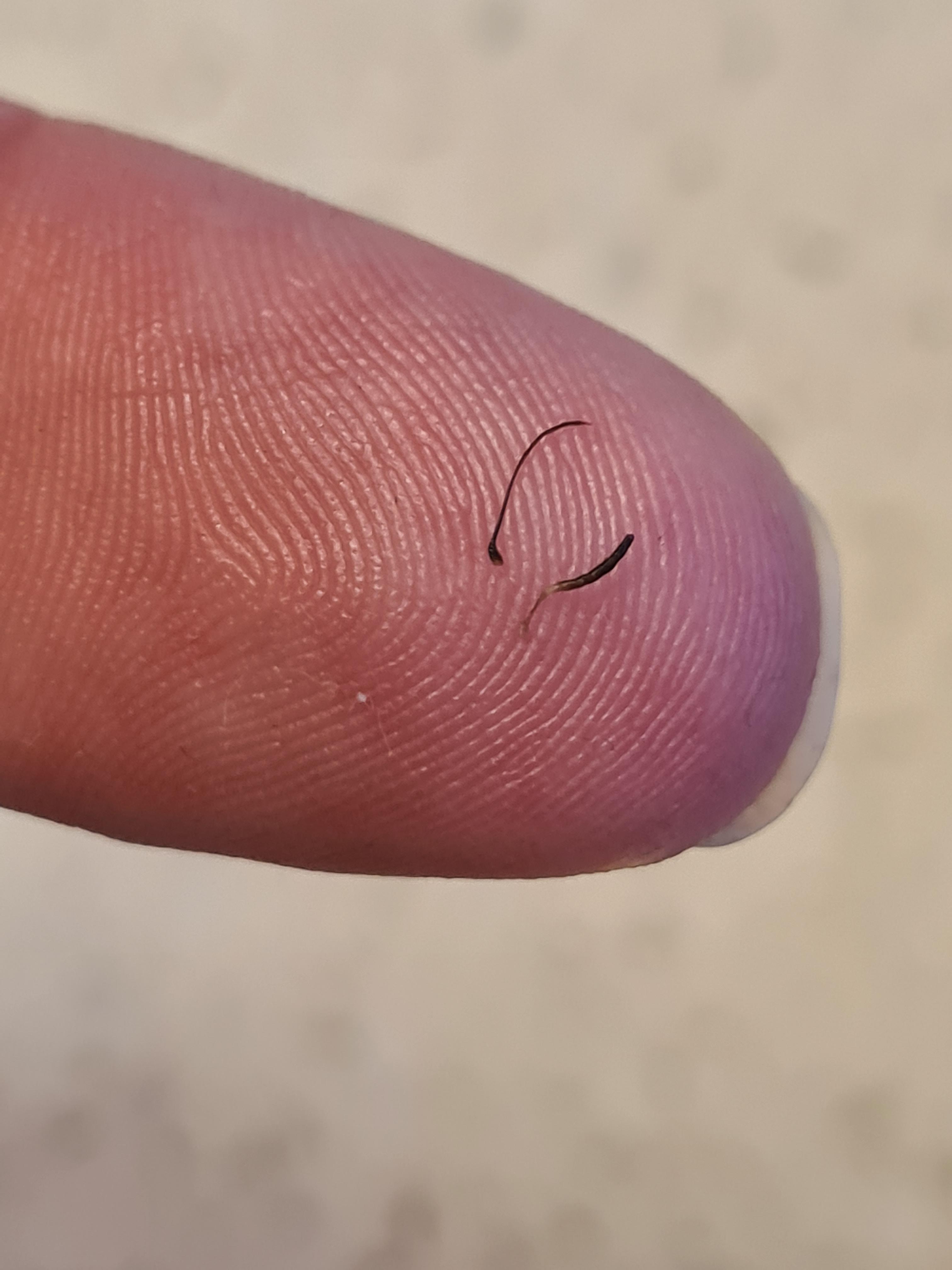 I keep getting these thick ingrown hairs like splinters in my beard